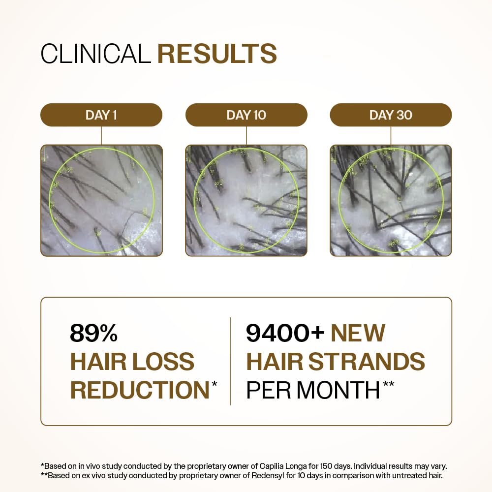 Bare Anatomy Advanced Hair Growth Serum| 3% Redensyl - 2x Better Results than Minoxidil | + 4% Anagain + 3% Baicapil | Rosemary, Biotin | Hair growth & Hair fall control serum for Women & Men | 30mL - Medaid International
