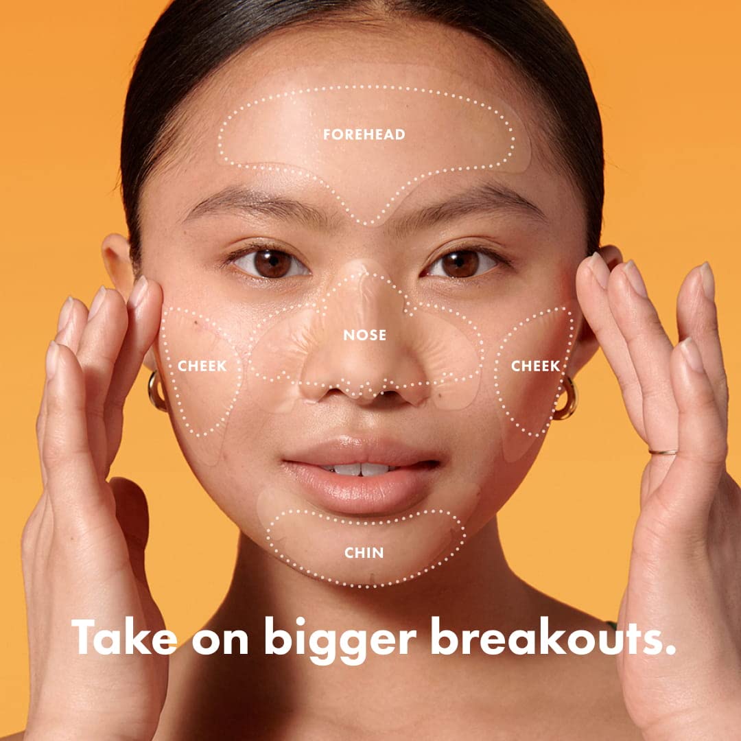 Hero Cosmetics Mighty Patch™ Face Patch - XL Hydrocolloid Face Mask for Acne, 5 Large Pimple Patches for Zit Breakouts on Nose, Chin, Forehead & Cheeks (1 Count) - Medaid International