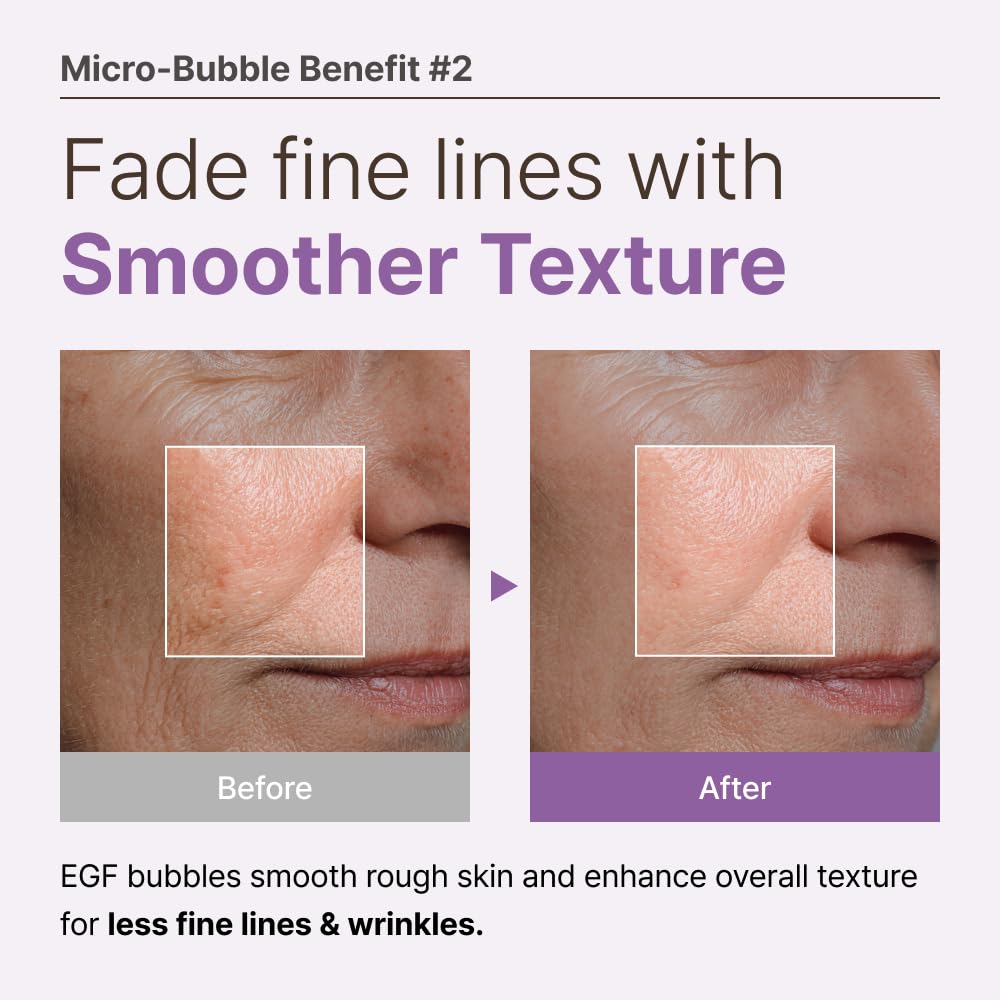 MENOKIN 30 Seconds Quick Bubble Mask [REPAIR] - [EGF Liposome] in Micro-bubbles for Skin Restoration, Hypoallergenic Bubble Capsule for Deep Repair, Korean Skin Care Essential, 70 Uses, fl.oz - Medaid International