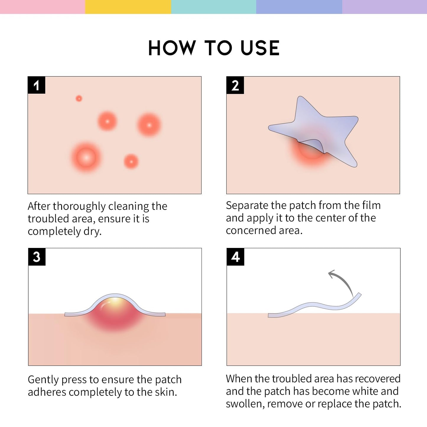 Star Spot Acne/Pimple Patch For Face, Hydrocolloid, Niacinamide, Ceramide, Cute Pastel Colors, Protecting & Healing, Prevent scarring, Blemish remover, Ideal for Blemish Spots, made in Korea 80 counts - Medaid International