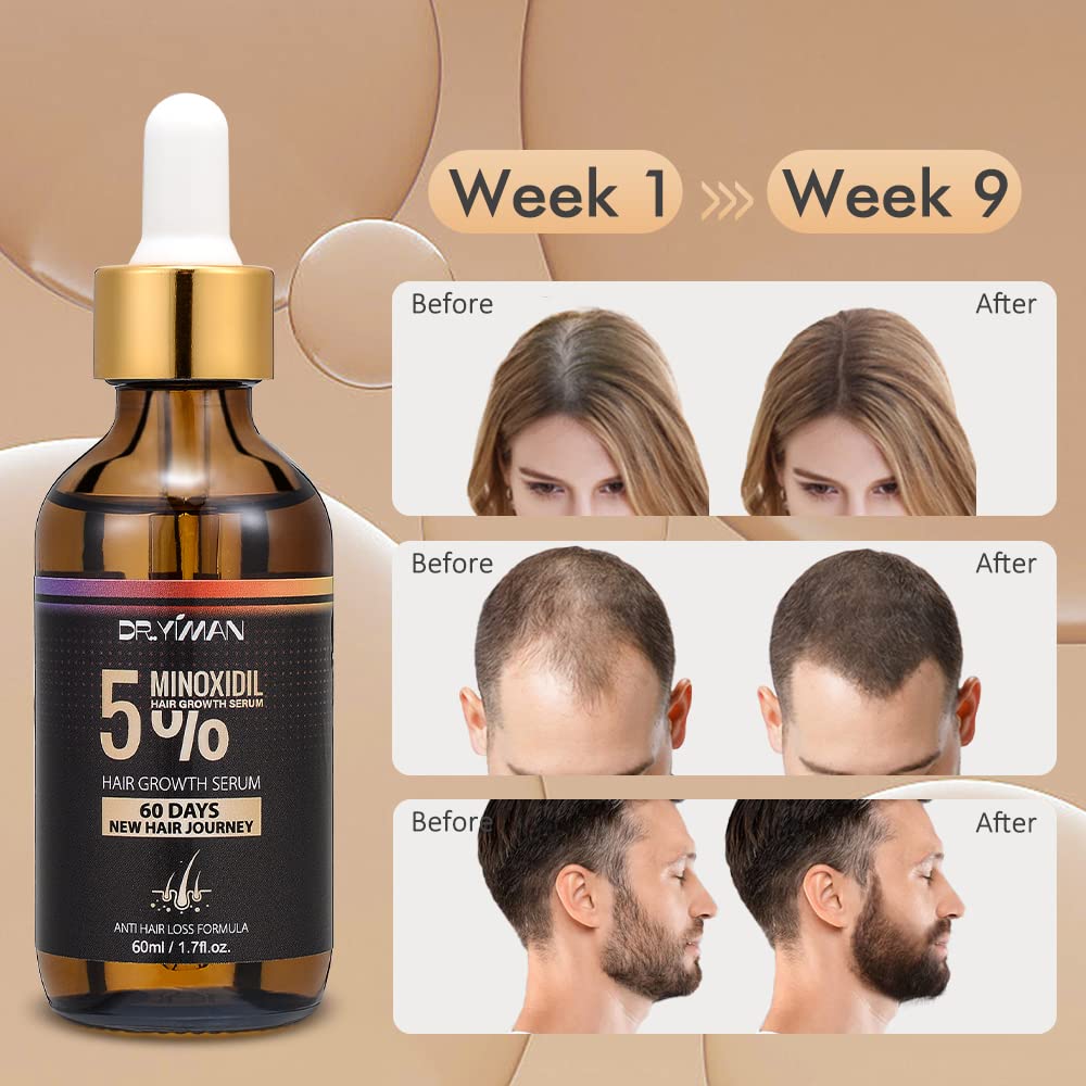 Dr.Yiman 5% Minoxidil Hair Growth Serum for Men and Women, Hair Growth Serum Oil for Hair Loss for Women, Safest Hair Growth Minoxidil Treatment for Boosting Follicles, Hair Regrowth Treatments - Medaid International