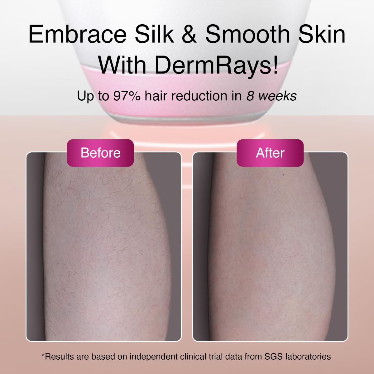 Upgrated Diode Laser Hair Removal for Dark Skin Tones, DermRays 1064nm Laser Hair Removal, Permanent Reduction in Hair Regrowth for Women and Men, V6S Suitable for Deep Skin Tone - Medaid International