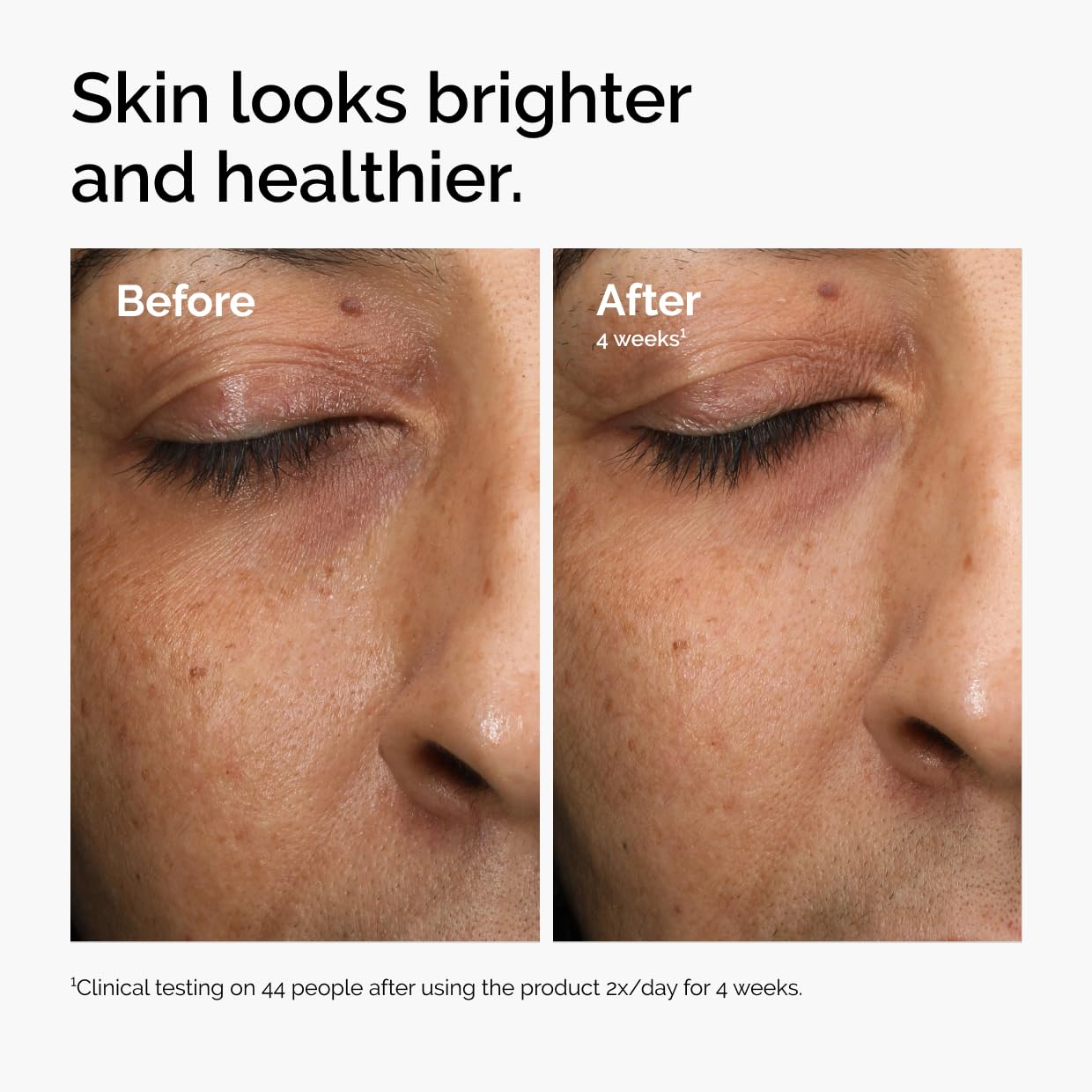 The Ordinary Multi-Antioxidant Radiance Serum, Vitamin C Serum For Face, Brighten & Protect Skin – Boosts Glow & Shields Against Environmental Stressors, 1 Fl Oz - Medaid International