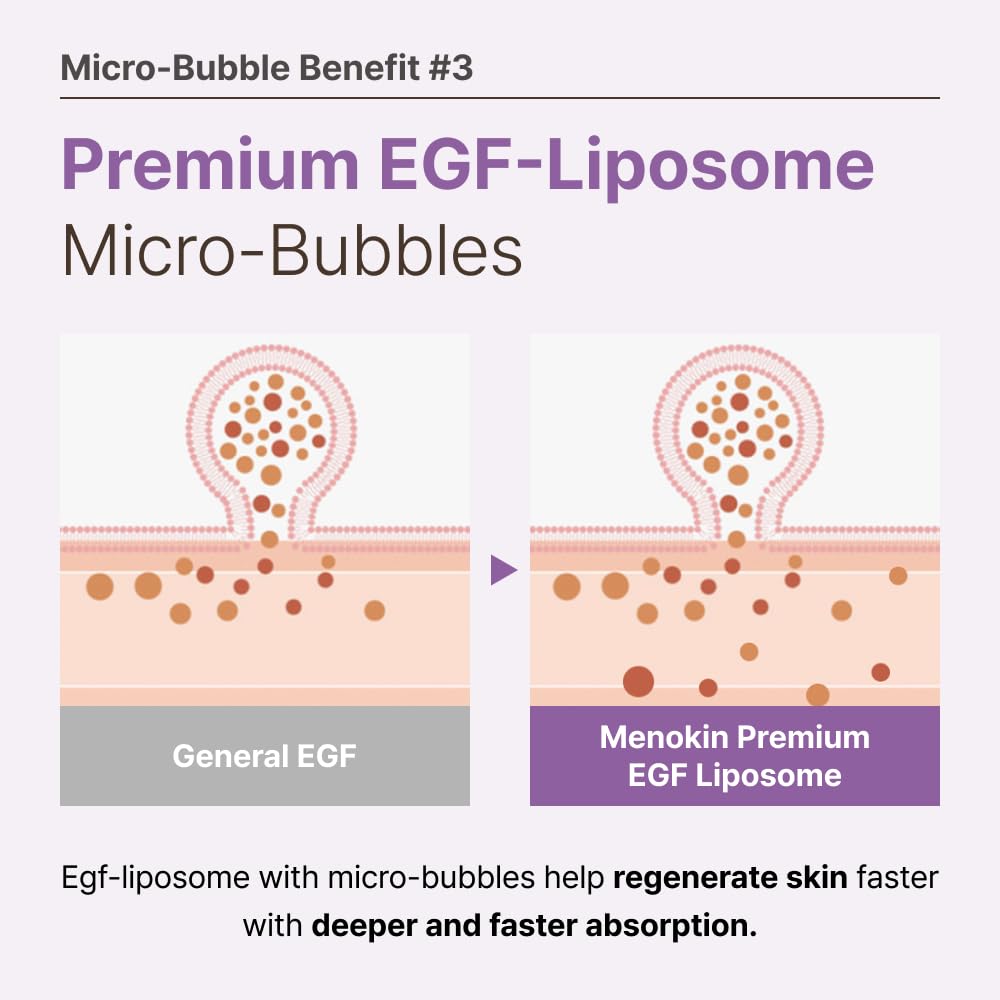 MENOKIN 30 Seconds Quick Bubble Mask [REPAIR] - [EGF Liposome] in Micro-bubbles for Skin Restoration, Hypoallergenic Bubble Capsule for Deep Repair, Korean Skin Care Essential, 70 Uses, fl.oz - Medaid International
