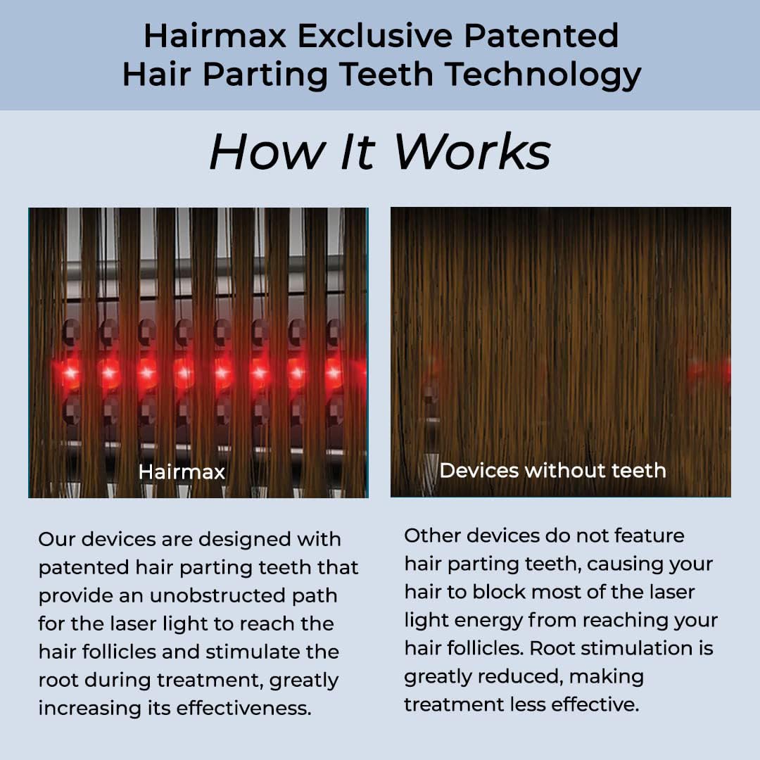 Hairmax Ultima 12 LaserComb - (FDA Cleared) Laser Hair Regrowth Treatment Device for Men & Women - Reverses Thinning Hair Loss - Red Light Therapy to Stimulate Hair Growth - Cordless Design - Medaid International