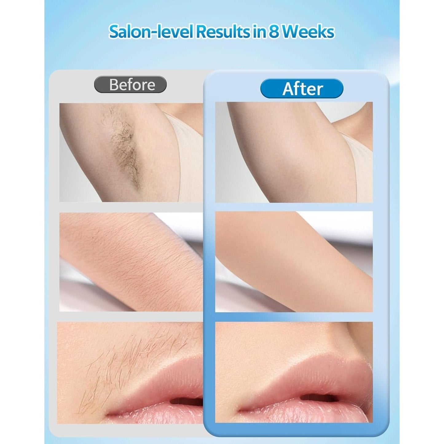OPT Laser Hair Removal For Women And Men, At-Home Laser Hair Removal with Ice Cooling,IPL Laser Hair Removel with 999999 Flashes, Hair Removal Device for Face Leg Armpit Arm Bikini Line, Max 25J - Medaid International