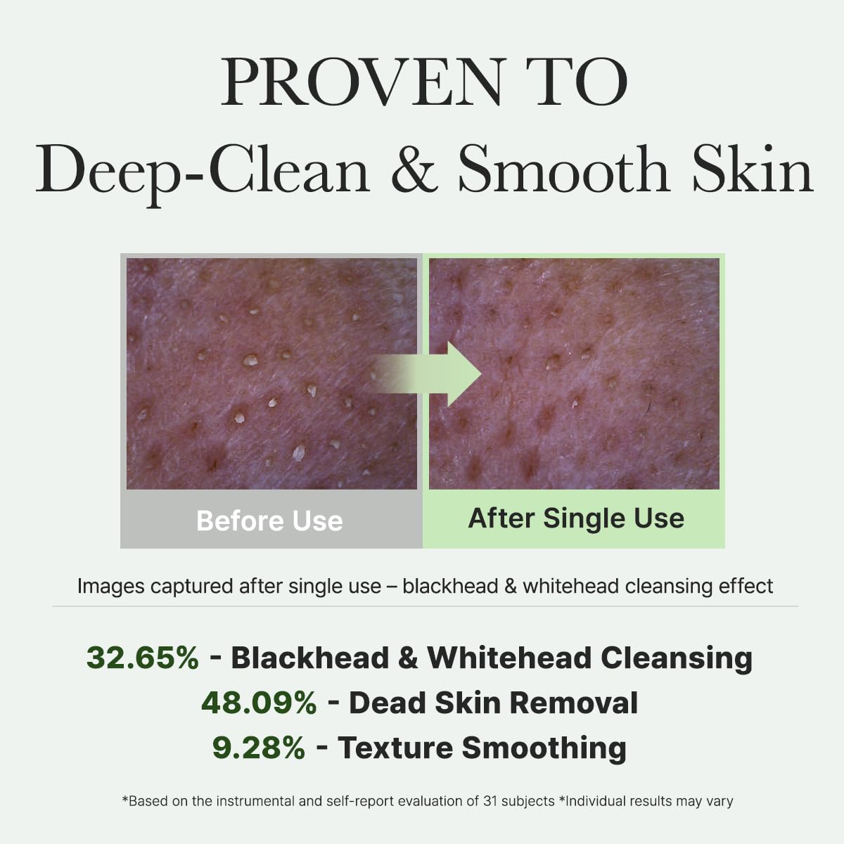 ARENCIA Korean Rice Mochi Face Cleanser - Face Wash, Gentle Scrub All in One for Deep Cleansing, Moisturizing, Pore Minimizing, Acne-Prone Skin, Removing Blackhead with Rice Water & Green Tea - Medaid International