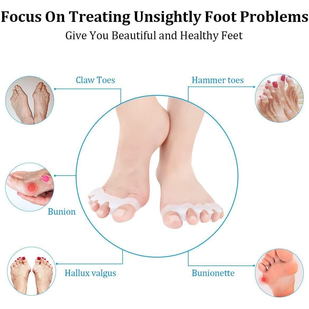 Toe Corrector