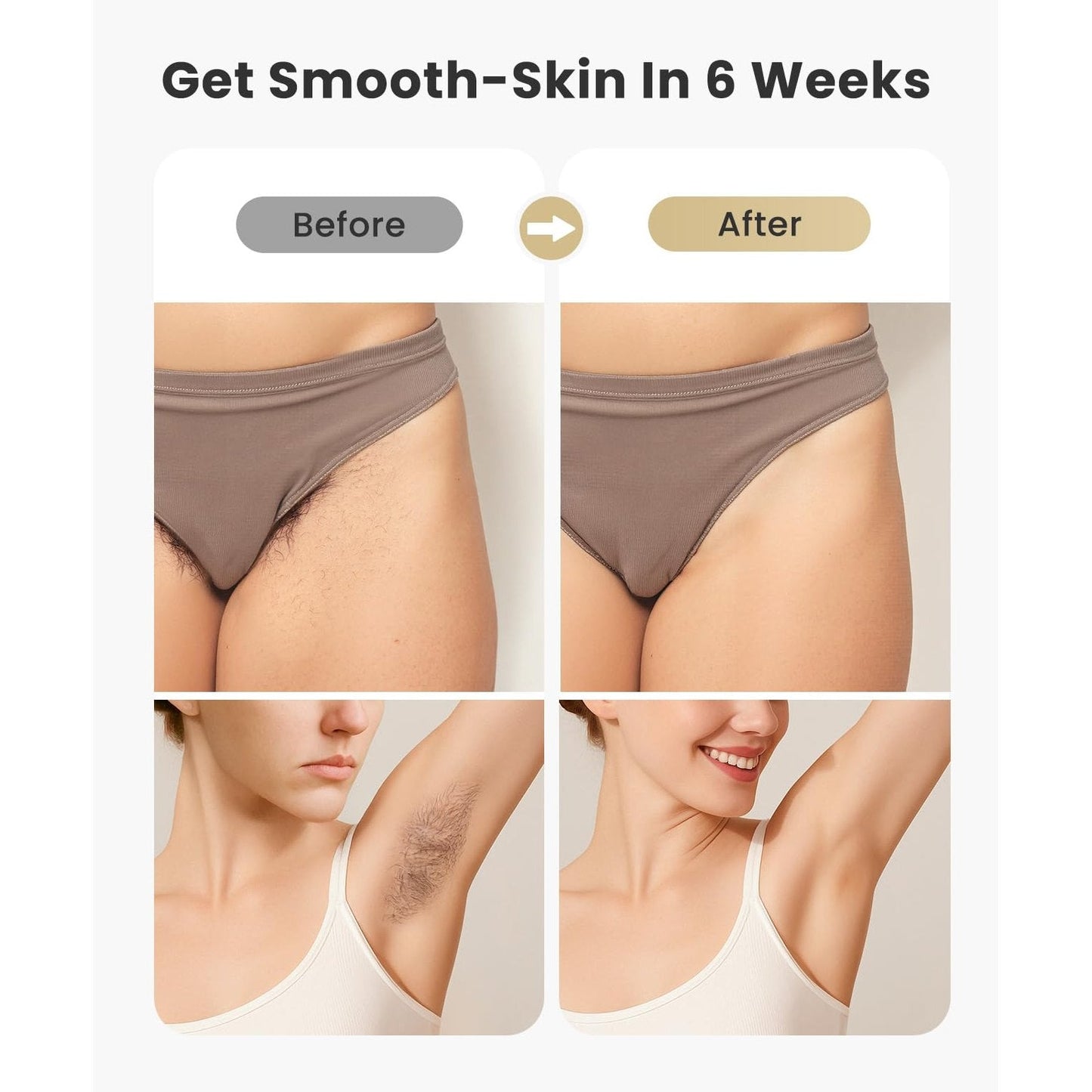 Laser Hair Removal for Women and Men - 5.2 cm² Contact Nearly Painless, Powerful Long-Lasting IPL Hair Removal at-home, Effective in 14 Days with Ultra-fast Light Emission for Whole Body Use - Medaid International