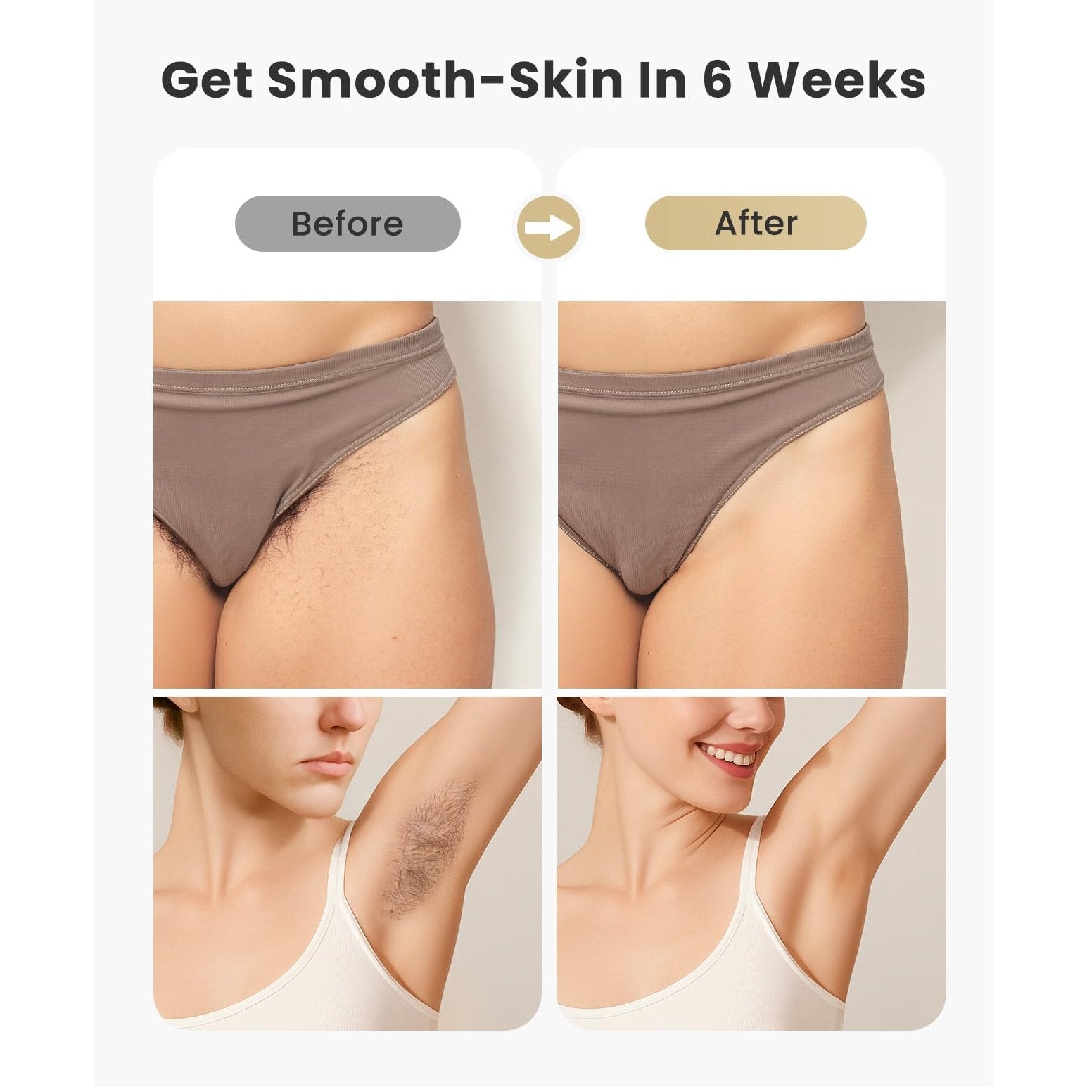 Laser Hair Removal for Women and Men - 5.2 cm² Contact Nearly Painless, Powerful Long-Lasting IPL Hair Removal at-home, Effective in 14 Days with Ultra-fast Light Emission for Whole Body Use - Medaid International