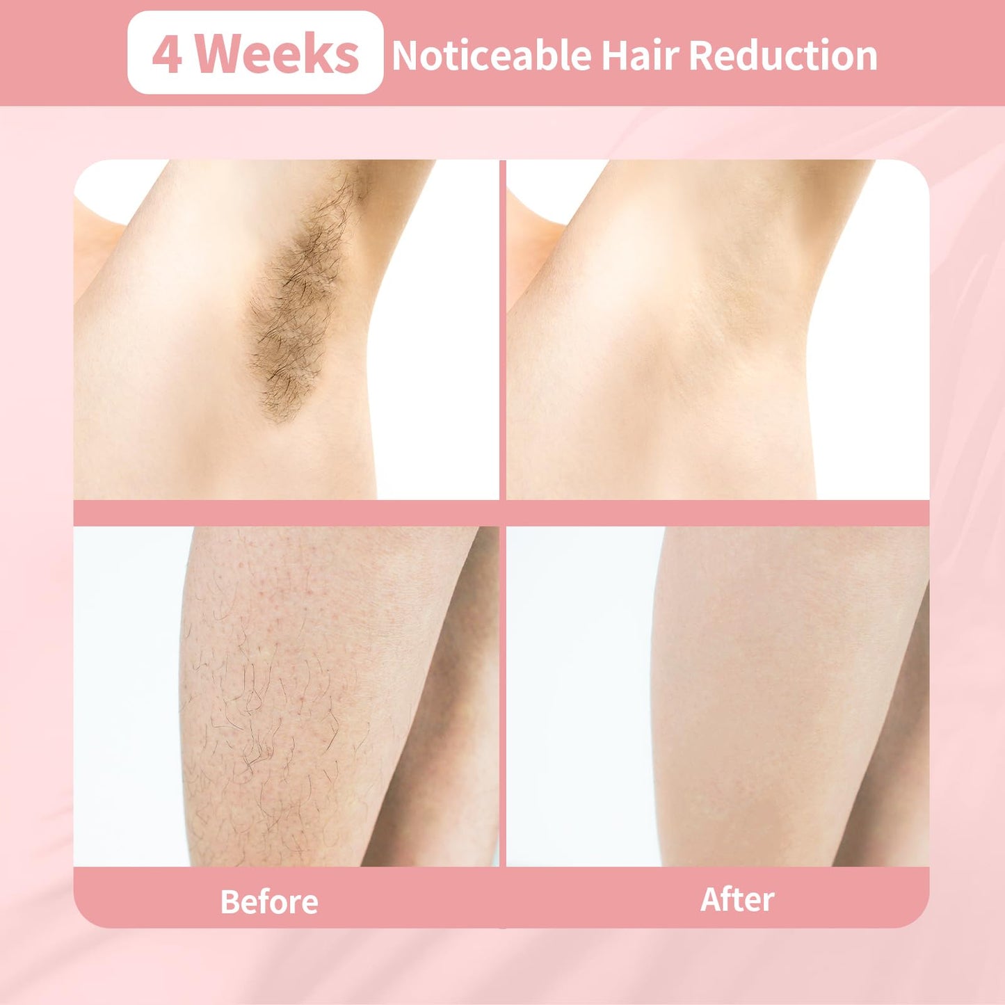 REEOOH Professional Laser Hair Removal Machine, IPL Hair Removal Device with Ice Cooling, 3 in 1 Body Painless Home Laser Hair Removal for Face Legs, Ideal Choice for Women & Men - Medaid International