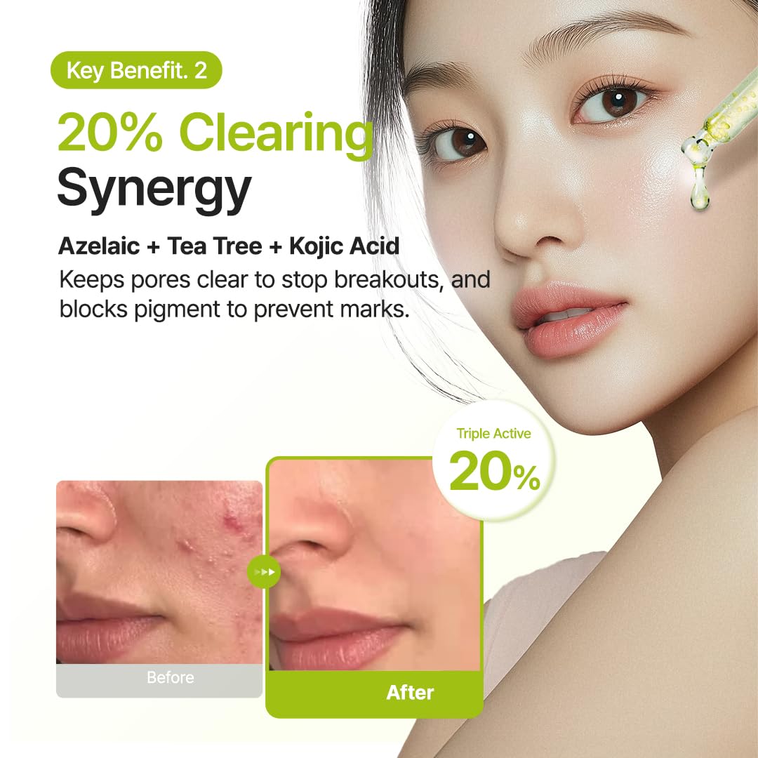 PURITO Azelaic Acid 10% + Kojic Acid + Tea Tree Facial Serum | for Acne & Marks, Breakouts | High-Level Azelaic Acid 10% | Korean skincare, 30mL 1.01 fl.oz - Medaid International