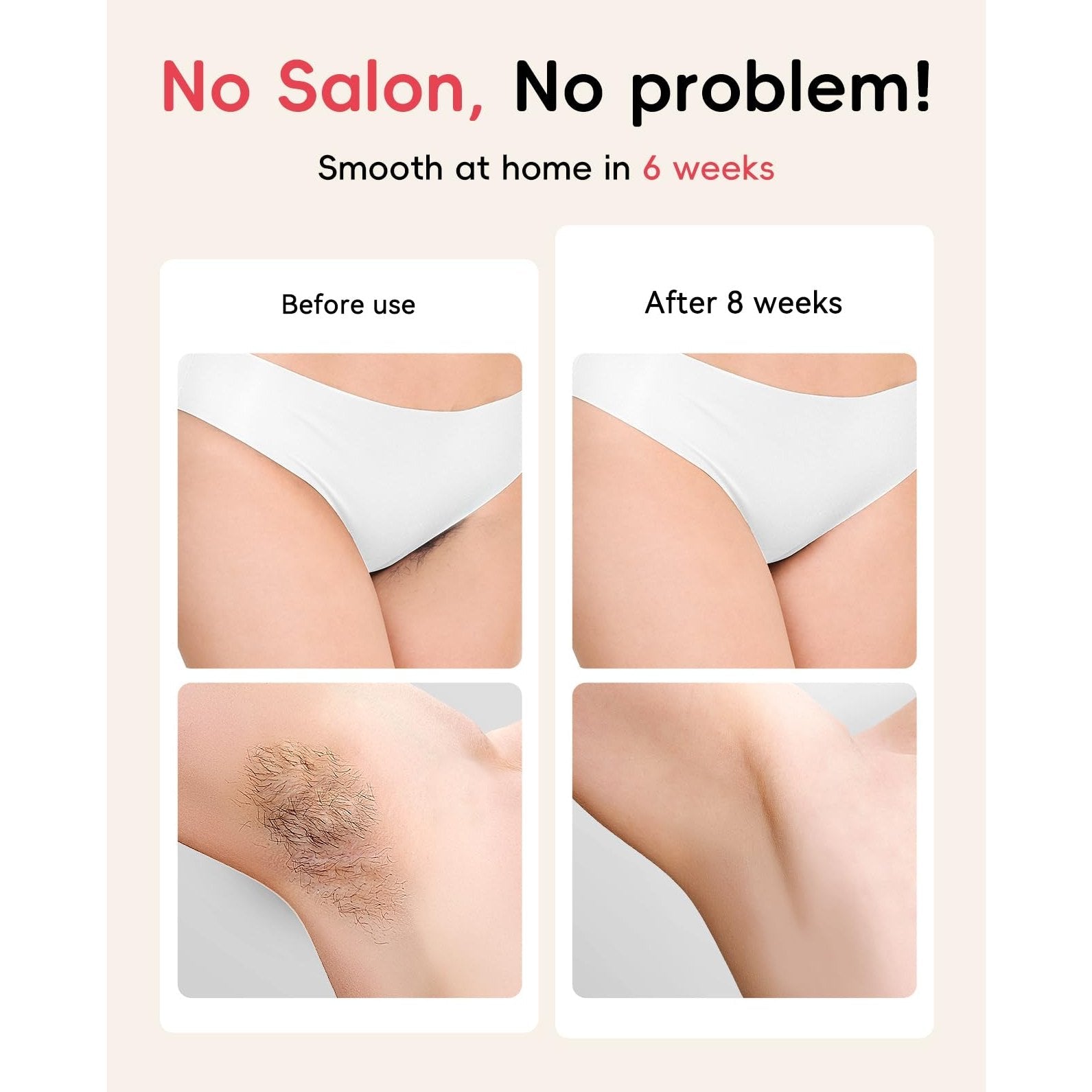 LYSMOSKI IPL Hair Removal Device, Laser Hair Removal for Women and Men, Painless Safe at-Home Hair Removal Device for Armpits Back Legs Arms Face Bikini Line - Medaid International