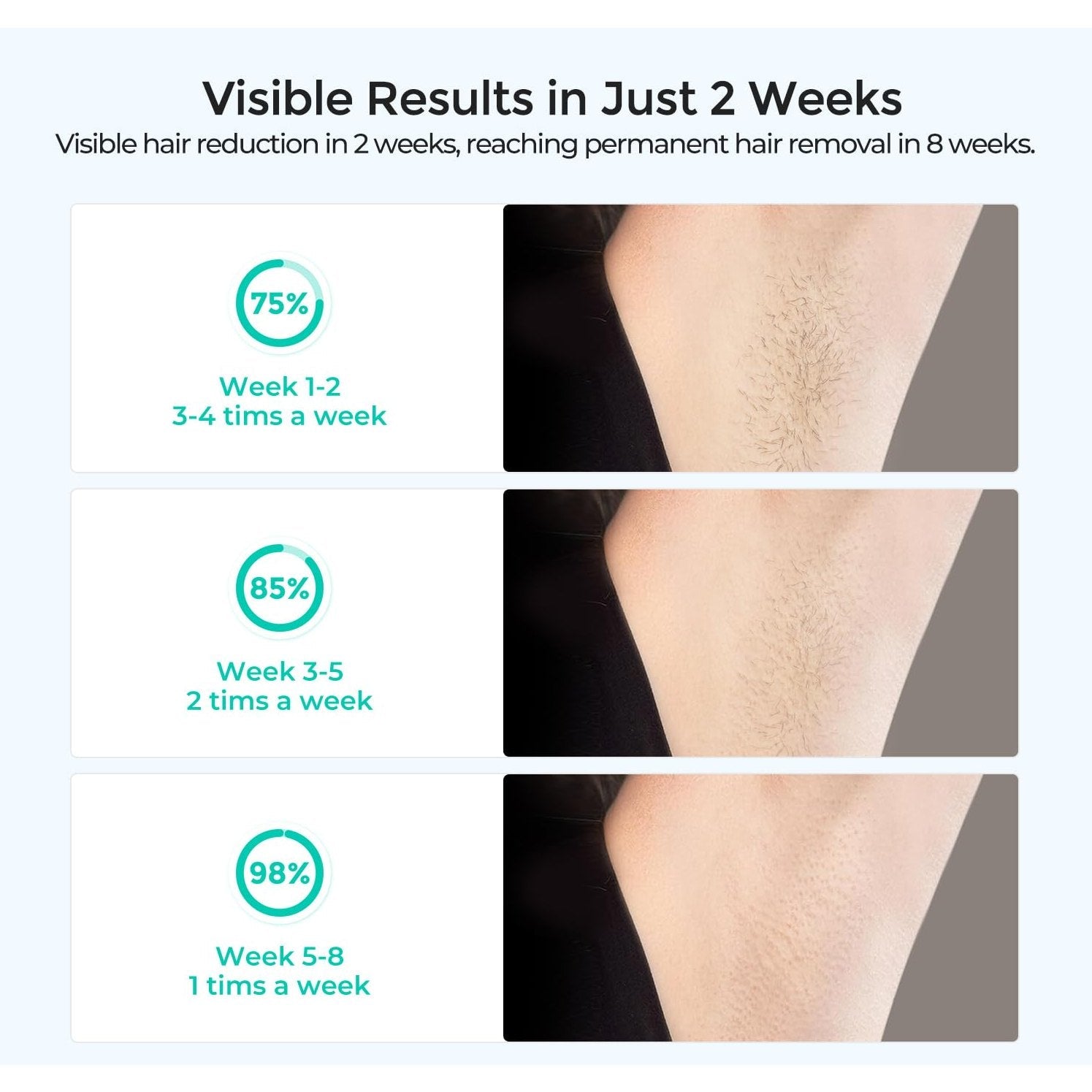 LUBEX Laser Hair Removal for Women and Men, Permanent IPL Hair Removal Device with IGBT Technology(3-Minute Whole Body Hair Removal),at Home Hair Remover 1000000+ Flashes for Legs Bikini Arms Use - Medaid International