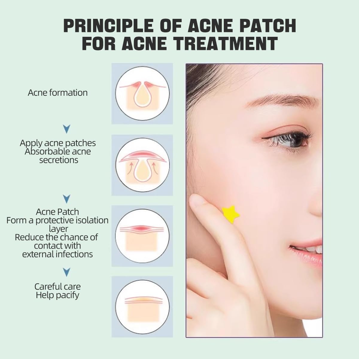 Vavilente Pimple Patches for Face Zit Dots,Hydrocolloid Pimple Patch Star with Tea Tree Oil Acne Patches Invisible,Star Face,Cute Acne Patch-Day and Night Use(200 Count) - Medaid International