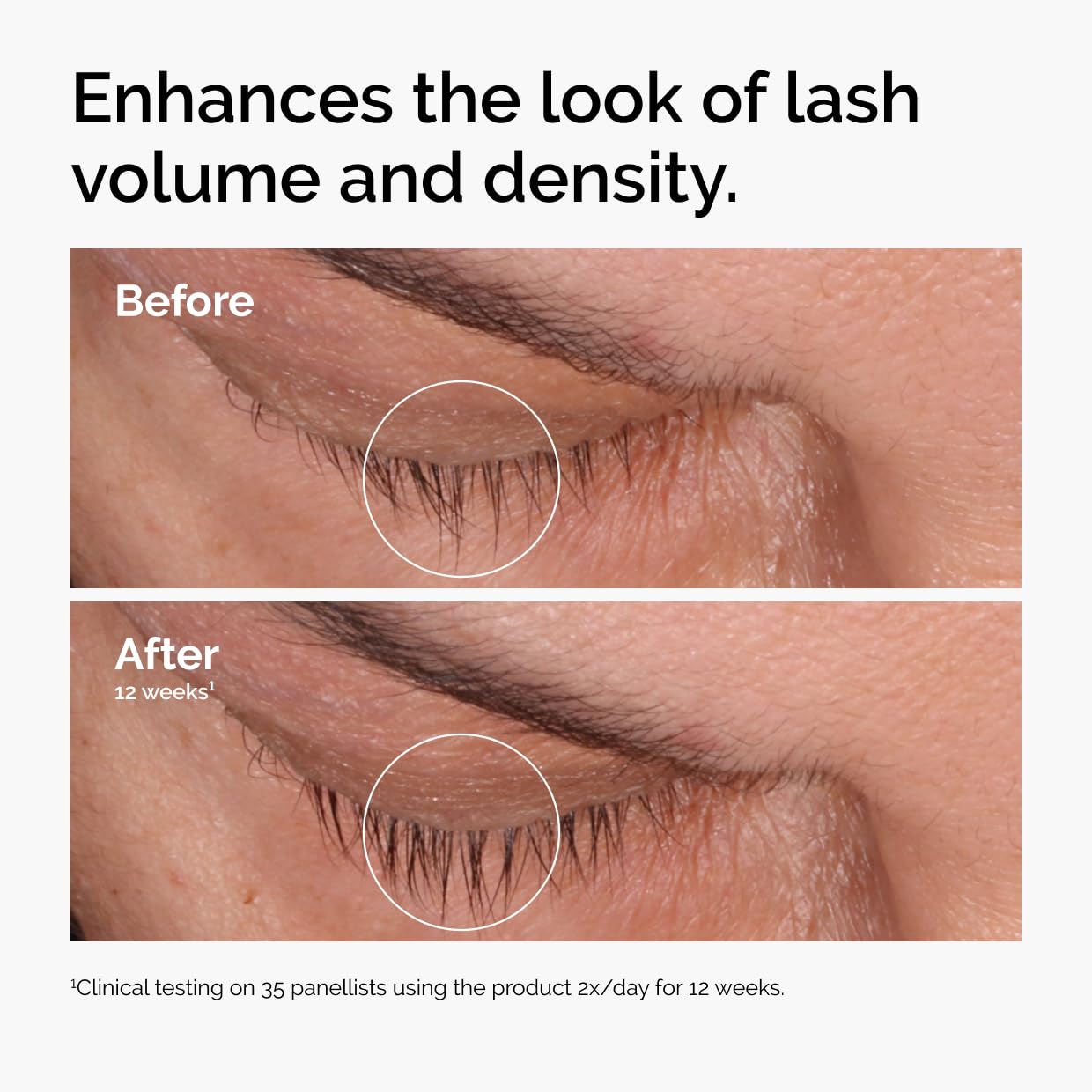 The Ordinary Multi-Peptide Lash and Brow Serum, Peptide-Powered Formula for Thicker, Fuller Looking Lashes & Brows, 0.16 Fl Oz - Medaid International