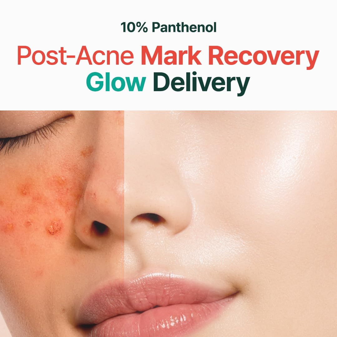 PURITO Post-Acne Moisturizer, Recovery & Glow Boost, Silicone-Free, Non-Comedogenic, Vegan, Korean Skincare, Mighty Bamboo Panthenol Cream, 3.38 fl oz / 100ml - Medaid International