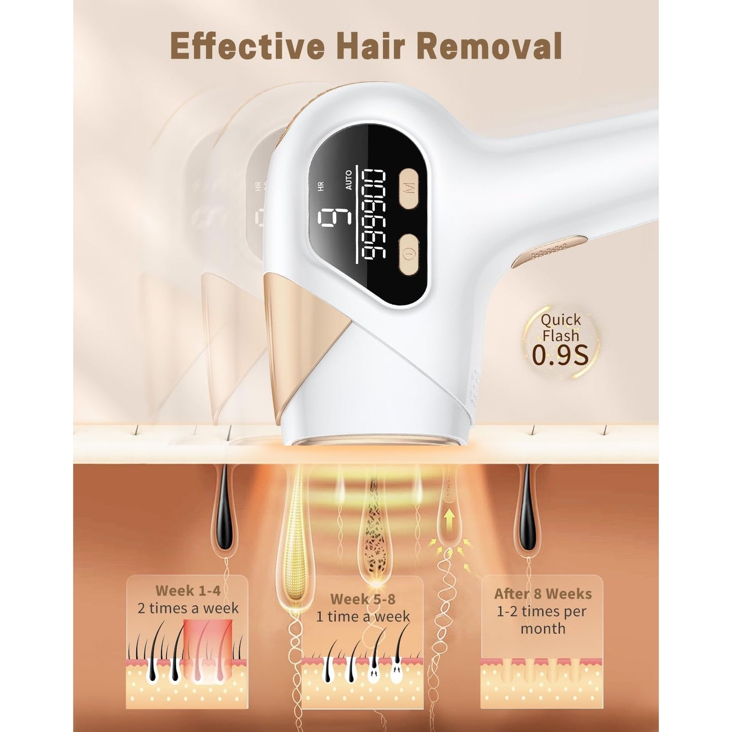 LYSMOSKI IPL Hair Removal Device, Laser Hair Removal for Women and Men, Painless Safe at-Home Hair Removal Device for Armpits Back Legs Arms Face Bikini Line - Medaid International