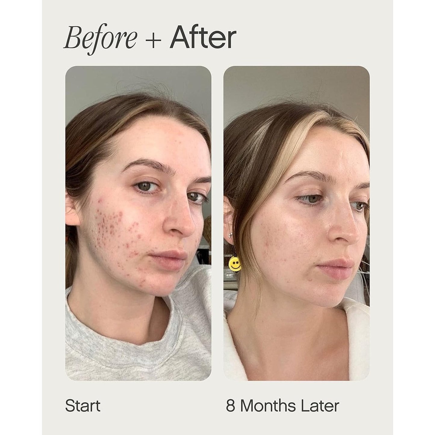 Topicals Faded Brightening and Clearing Serum | Reduces Discoloration, Post-Blemish Marks, Scars and Spots | Contains Kojic Acid and Niacinamide | Dermatologist-tested, Vegan, Cruelty-Free (0.5 Fl Oz) - Medaid International
