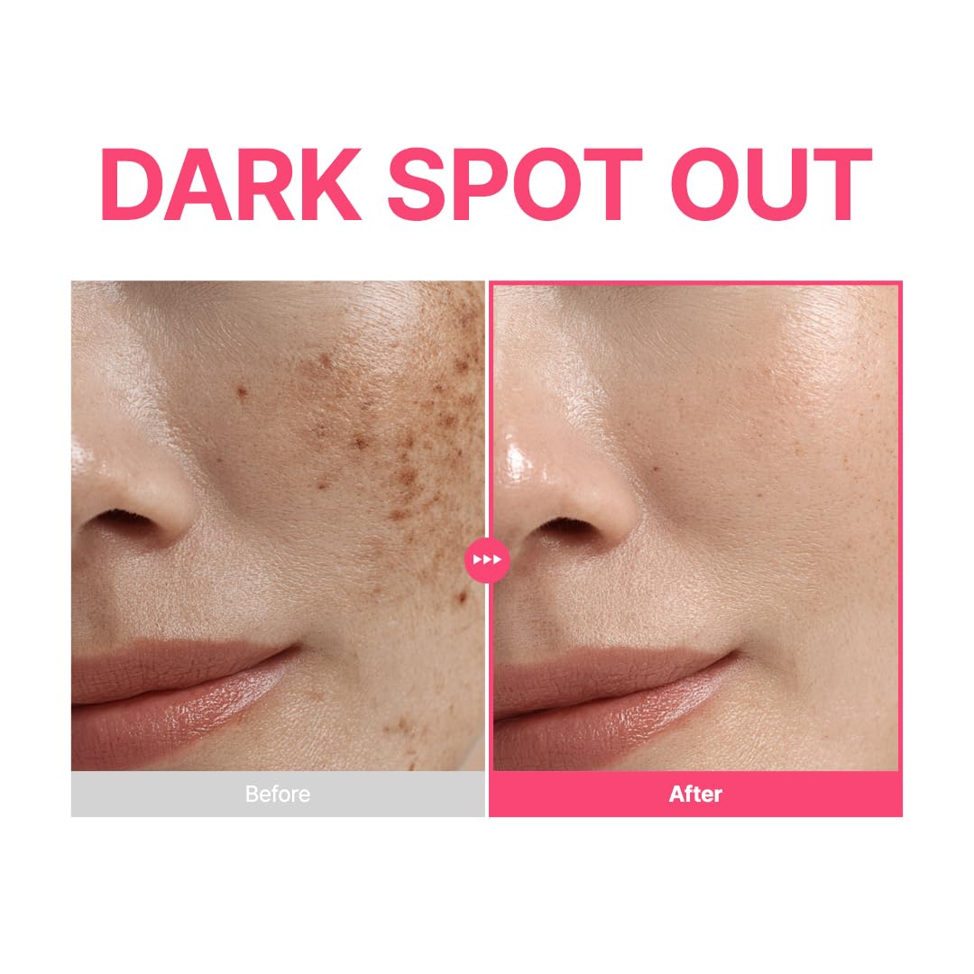 PURITO TXA 6% + Niacinamide 10% + Retinal Facial Serum | for Dark Spots, Hyperpigmentation, Uneven Tone | High-Level Tranexamic Acid 6% | Korean skincare, 30mL 1.01 fl.oz - Medaid International