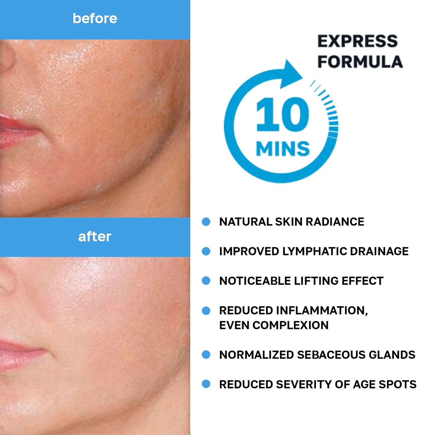 Name Skin Care Korean Carboxy CO2 Therapy Face & Neck Mask Set of 2 - Hydrating Oxygen Carboxytherapy Skincare Sheet Masks - Moisturizing Anti Aging Pore Tightening Brightening Facial Treatment Gel - Medaid International