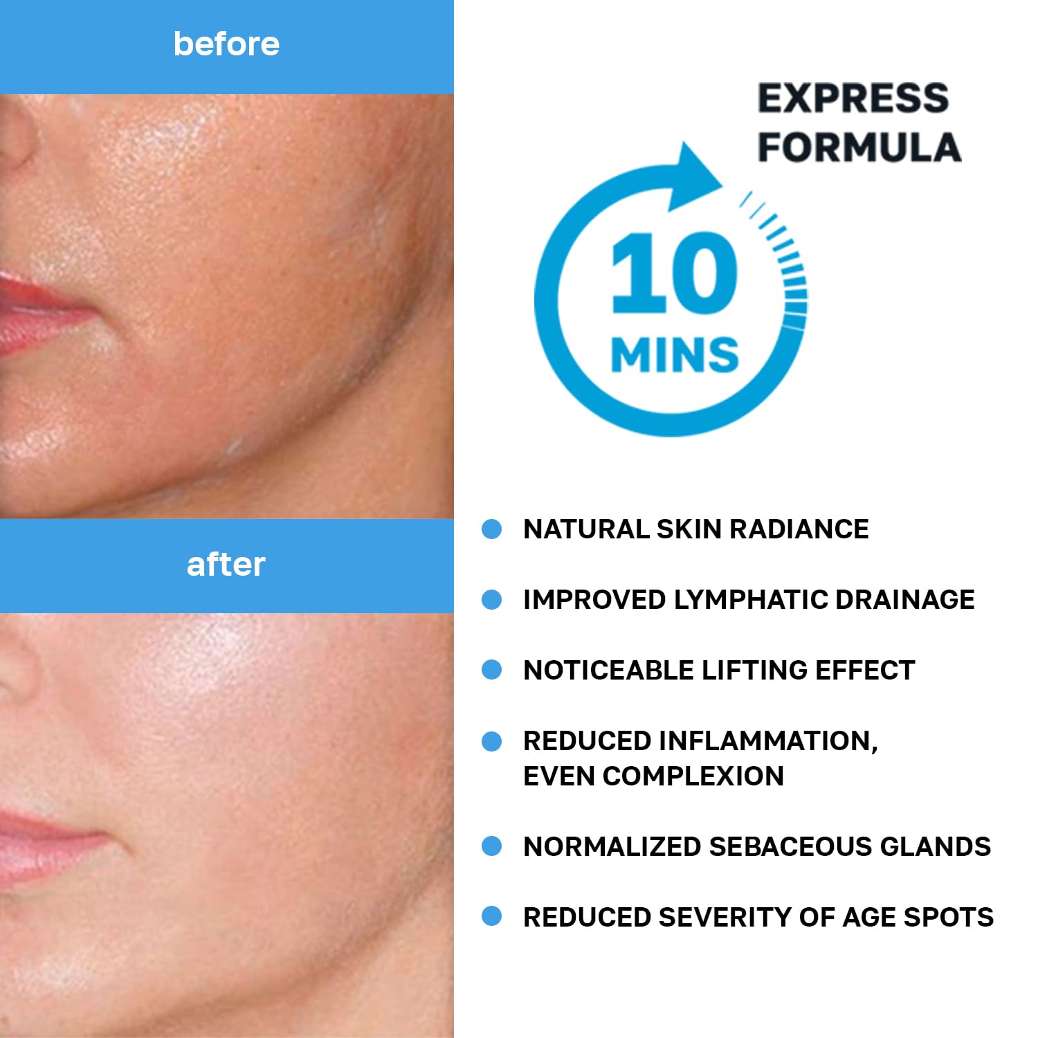 Name Skin Care Korean Carboxy CO2 Therapy Face & Neck Mask Set of 2 - Hydrating Oxygen Carboxytherapy Skincare Sheet Masks - Moisturizing Anti Aging Pore Tightening Brightening Facial Treatment Gel - Medaid International