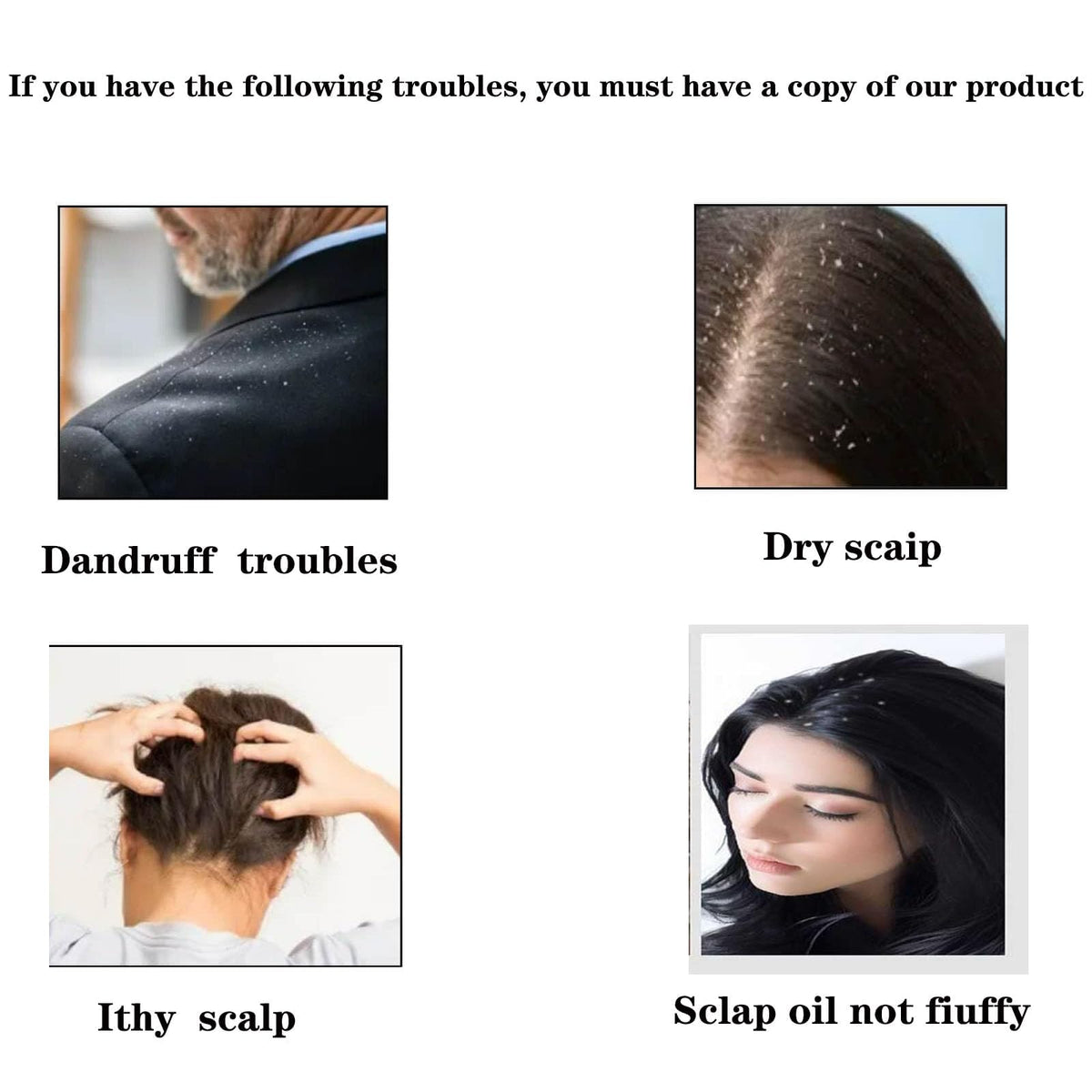 Kastwave Dandruff Comb, Massage Comb Hair, Energy Allows For The Effective Removal Of And Dirt, Healthier Scalp Better Hair Quality,