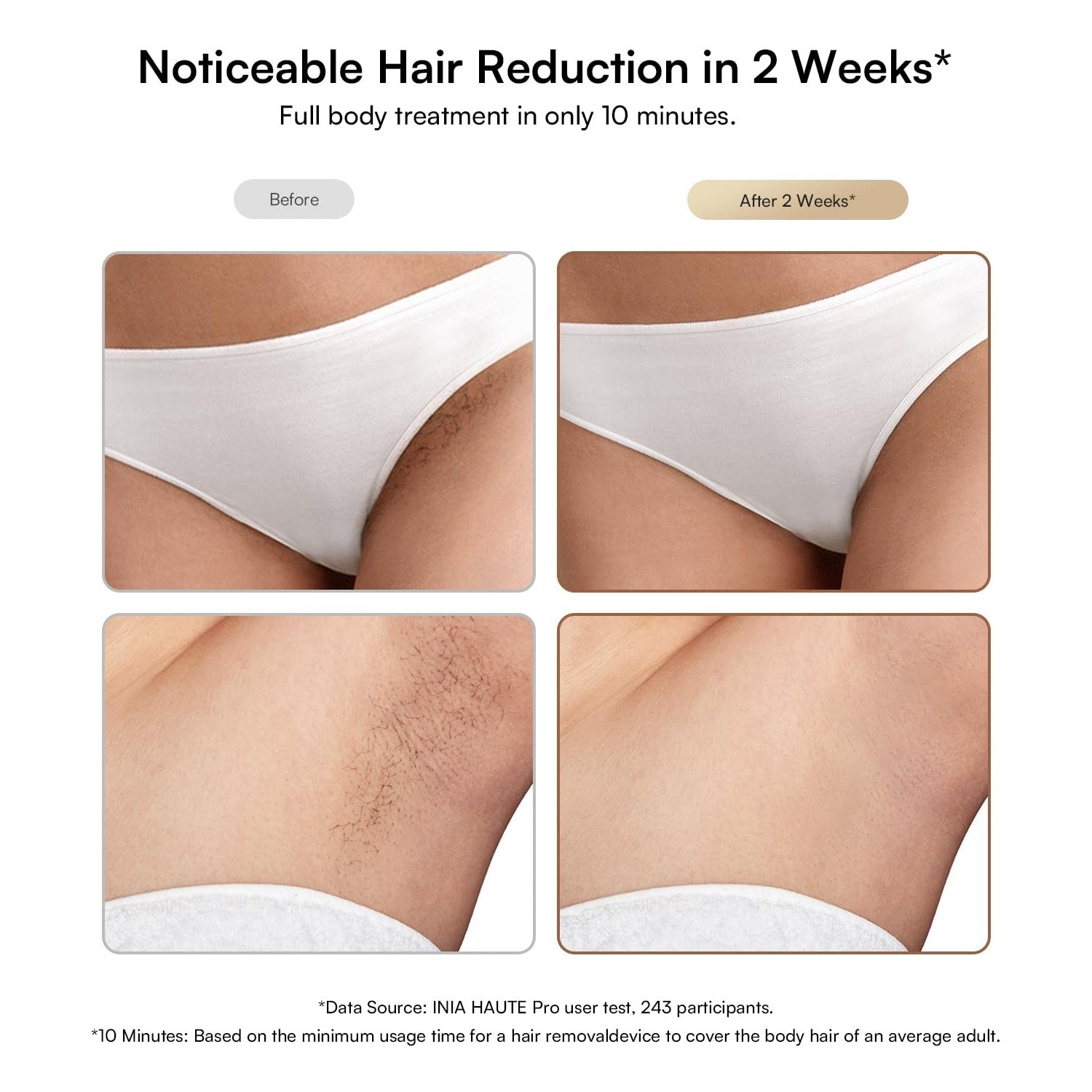 INIA Laser Hair Removal with Ice-Cooling Care for Women and Men, HAUTE Pro Painless at-Home IPL Hair Remover for Coarse Hair in Bikini and All Body Areas, Latest Generation for Effective Results - Medaid International