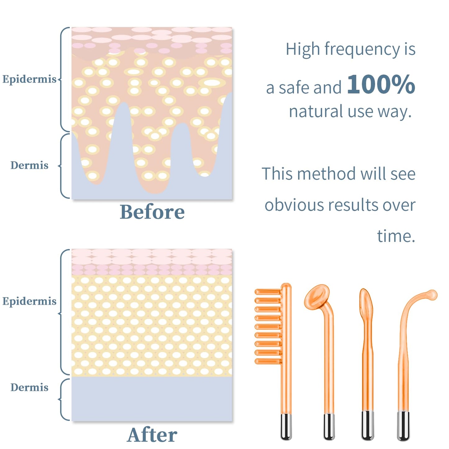 High Frequency Facial Machine - TUMAKOU Portable Handheld High Frequency Facial Skin Wand Machine with 4 Different Tubes - Medaid International