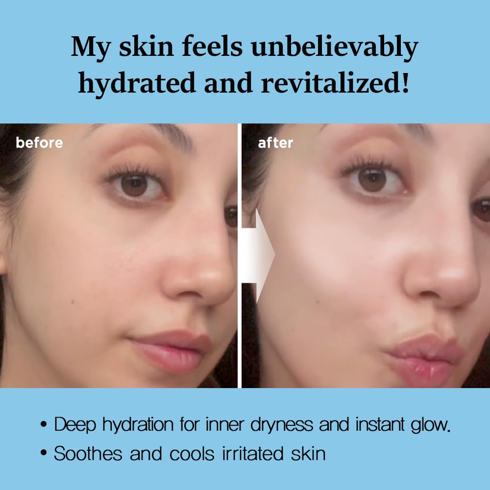 Nightingale Ecto-hyaluronic Soothing Mask, Hyaluronic Acid, Betula Alba Juice, Ectoin, Korean Hydrating Facial Mask, Alcohol Free, Korean Skin Care - Medaid International