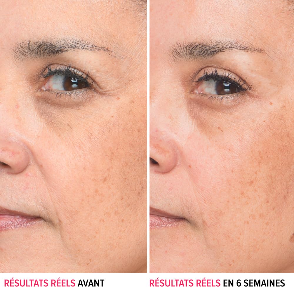 IT Cosmetics Bye Bye Lines Hyaluronic Acid Serum for Face - Hydrating Anti-Aging Facial Serum With Peptide & Vitamin B5, Visibly Plumps Skin, Smooths Look of Fine Lines, For All Skin Types - 1 fl oz - Medaid International