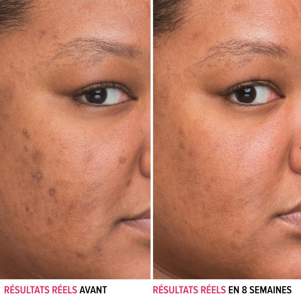 IT Cosmetics Bye Bye Dark Spots 4% Niacinamide Serum - Visibly Reduces Dark Spots & Improves Skin Clarity In 8 Weeks - Facial Serum with 1% Ethyl Vitamin C - For All Skin Types - 1 Fl. Oz - Medaid International