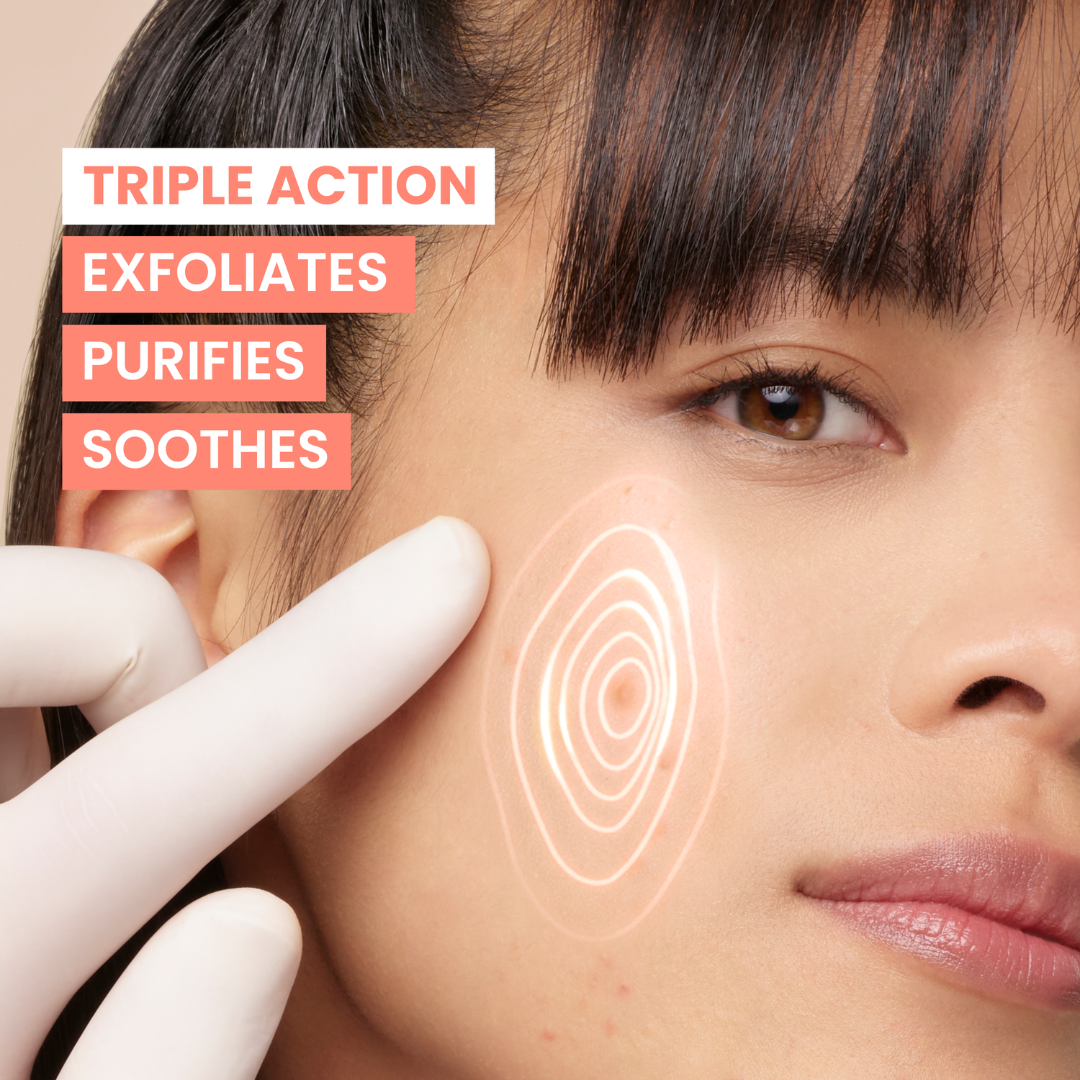 Avène Cleanance Comedomed Anti-Blemish Concentrate 30ml - Offer