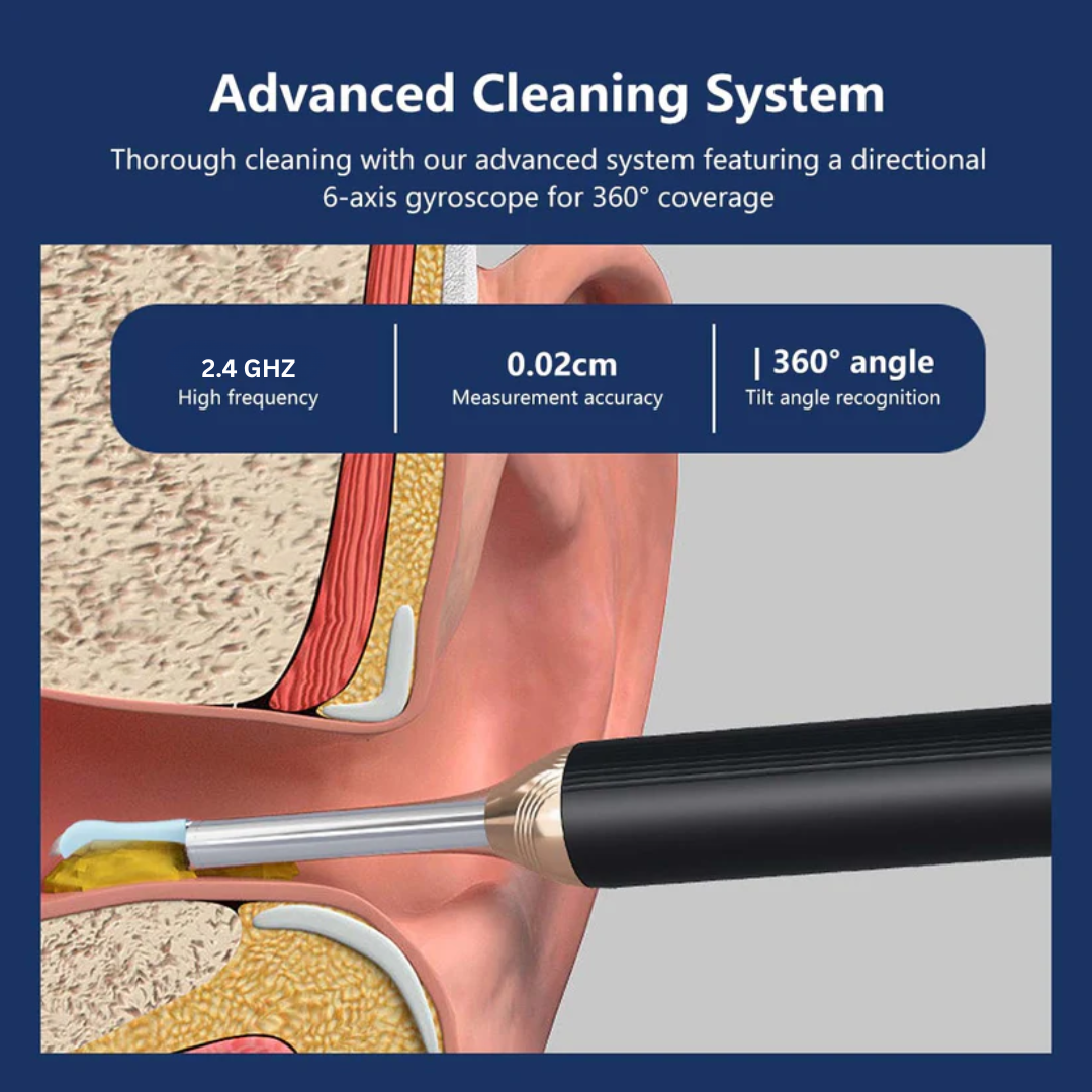 White Ear Wax Removal Tool with Camera – HD Ear Cleaner with 6 LED Lights - Medaid International