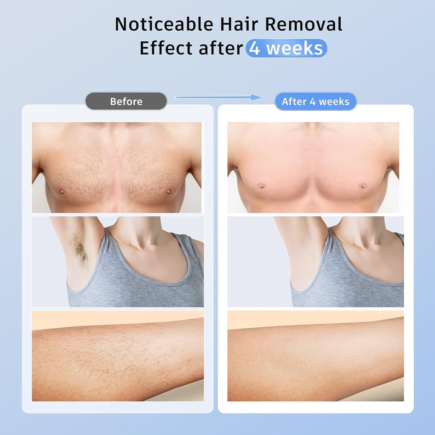 Laser Hair Removal Ubroo IPL Hair Removal Device with 5℃ Ice Cooling, 3 In 1 Painless Hair Removal For Women Men Permanent Face Body Beauty Care (Blue) - Medaid International