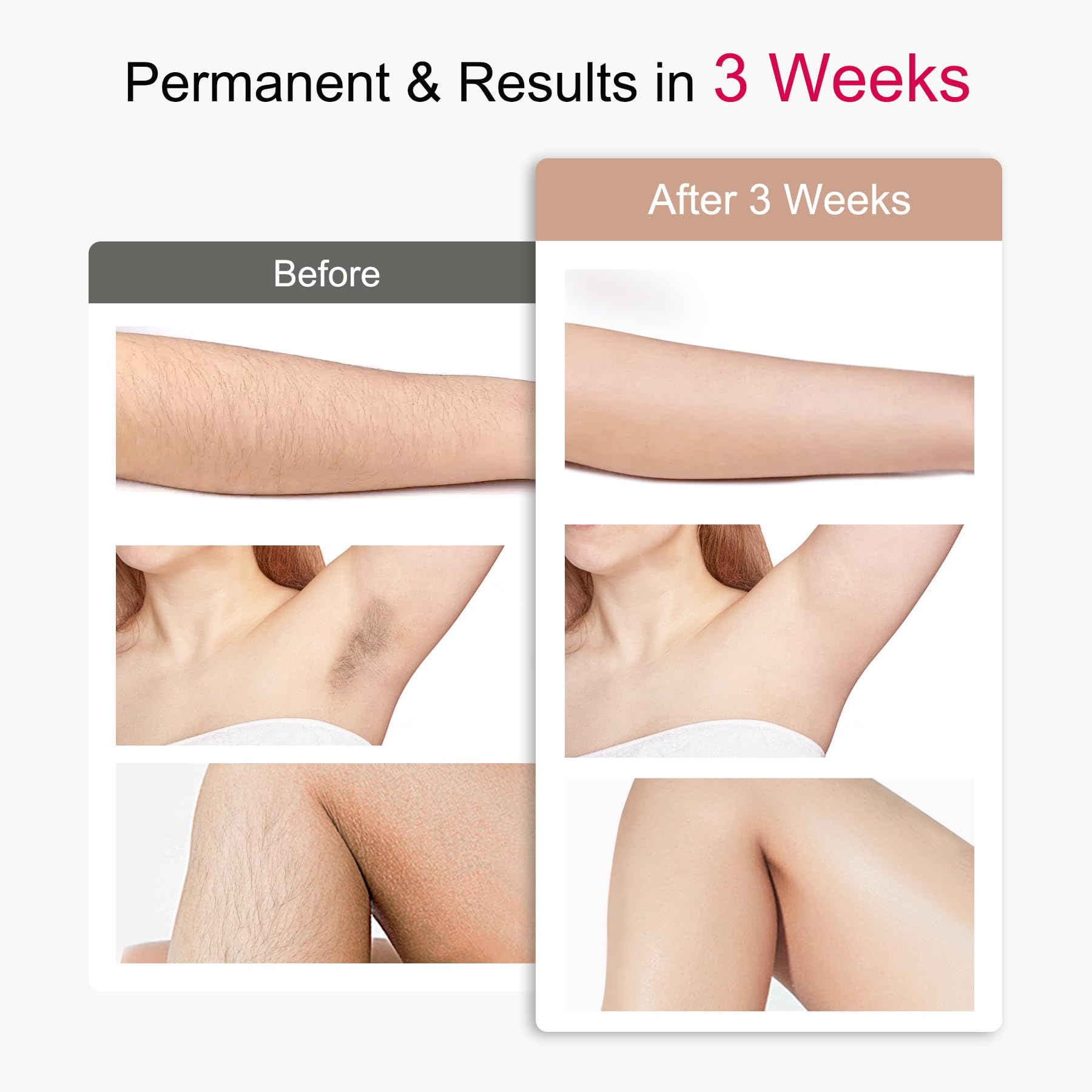 IPL Sapphire Laser Hair Removal Device for Women & Men with 45°F Ice-Cooling,Infinite Flash & Long-Lasting Results, Painless Hair Removal Device in 3 Weeks for Armpits Legs Arms Bikini Line At Home - Medaid International