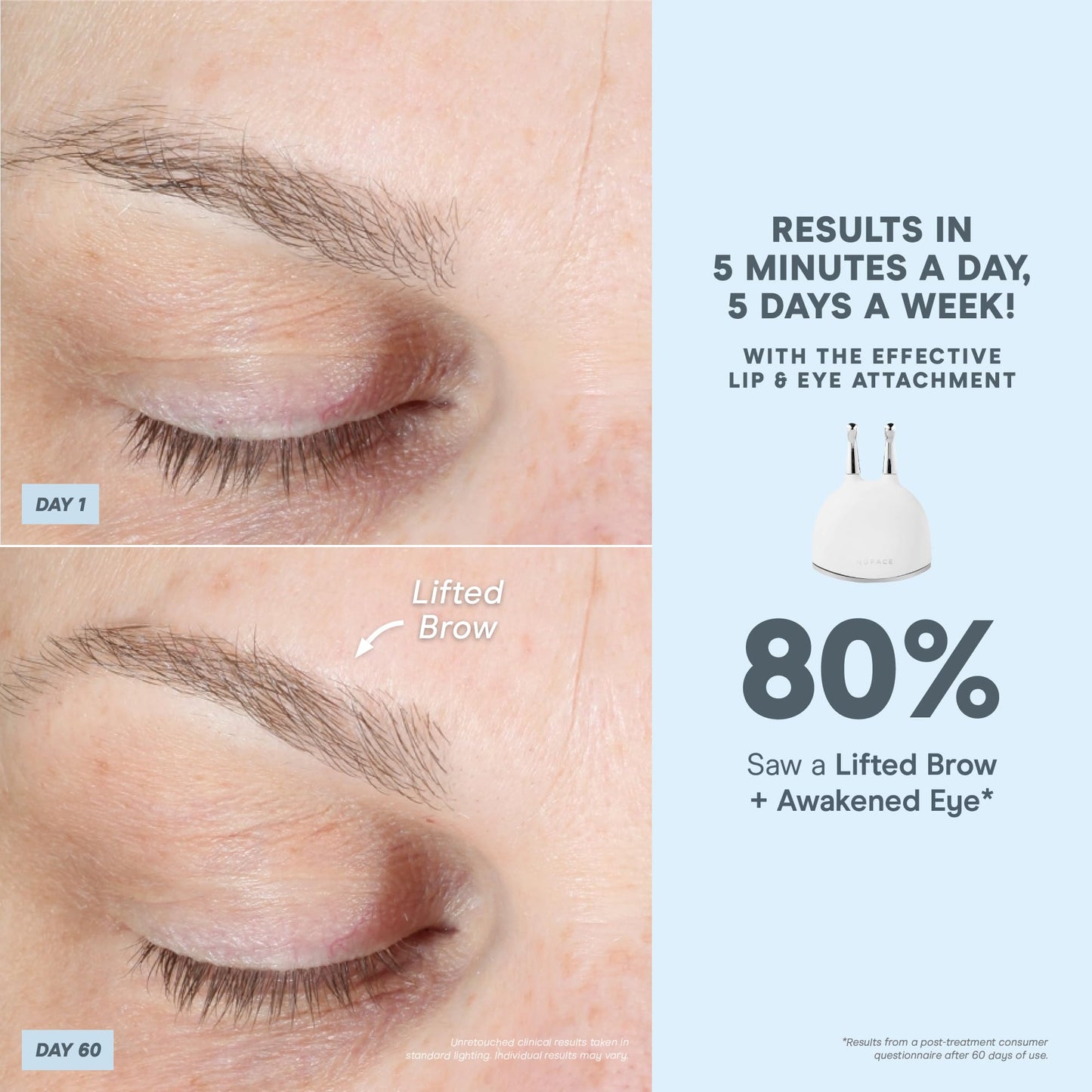 NuFACE Trinity+ Microcurrent Facial Device + Effective Lip & Eye Attachment - FDA Cleared Skin Tightening & Face Toning Device for Targeted Treatment + Microcurrent Gel Activator, Silk Crème & Brush - Medaid International