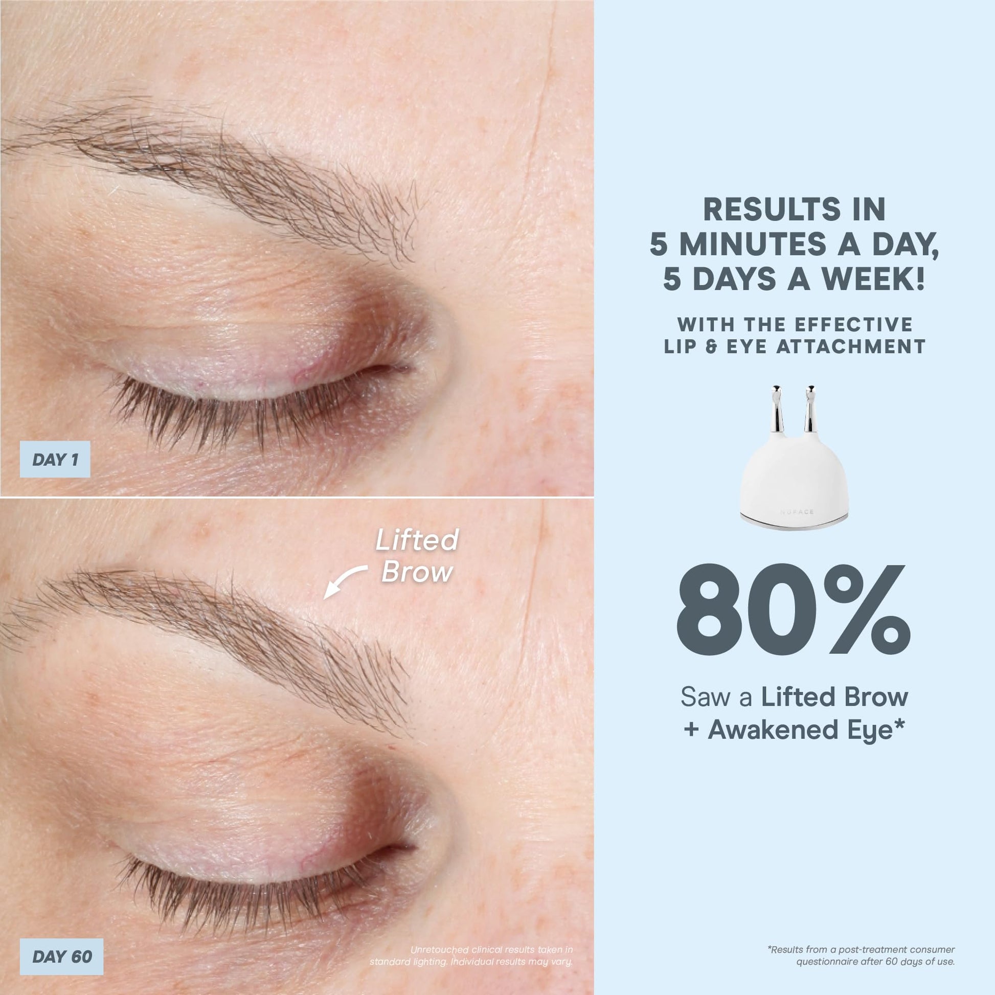 NuFACE Trinity+ Microcurrent Facial Device + Effective Lip & Eye Attachment - FDA Cleared Skin Tightening & Face Toning Device for Targeted Treatment + Microcurrent Gel Activator, Silk Crème & Brush - Medaid International