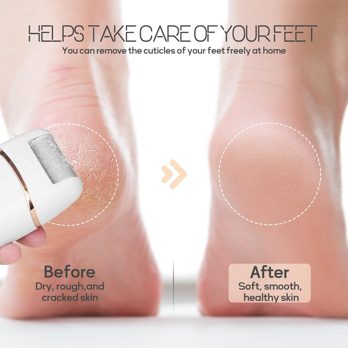 TERRIFI Automatic Callus Remover for Feet, Rechargeable Pedicure Tools, Electric Foot Callus Remover with 3 Roller Heads, 2 Speed Waterproof Foot File for Dead Hard Cracked Dry Skin