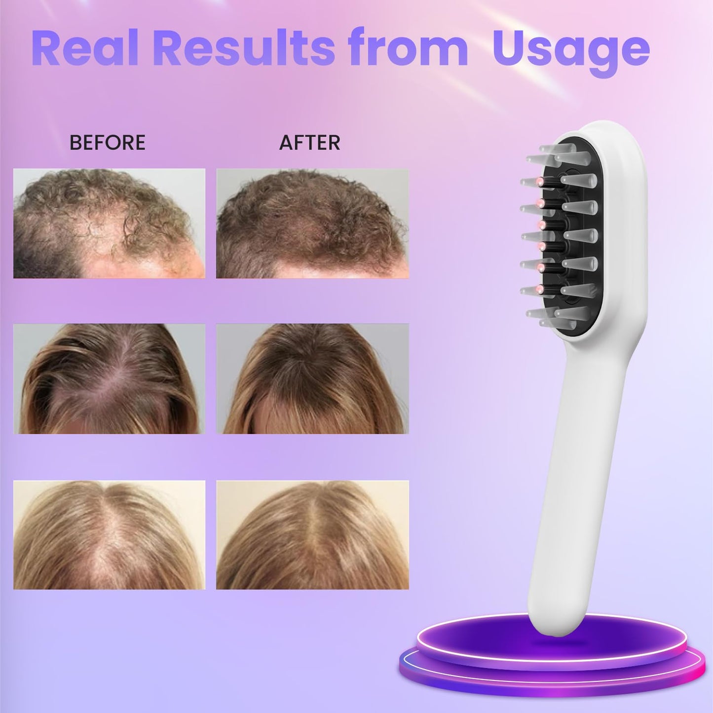 Laser Therapy Hair Growth Comb, Model: Lasercomb-001 - Medaid International
