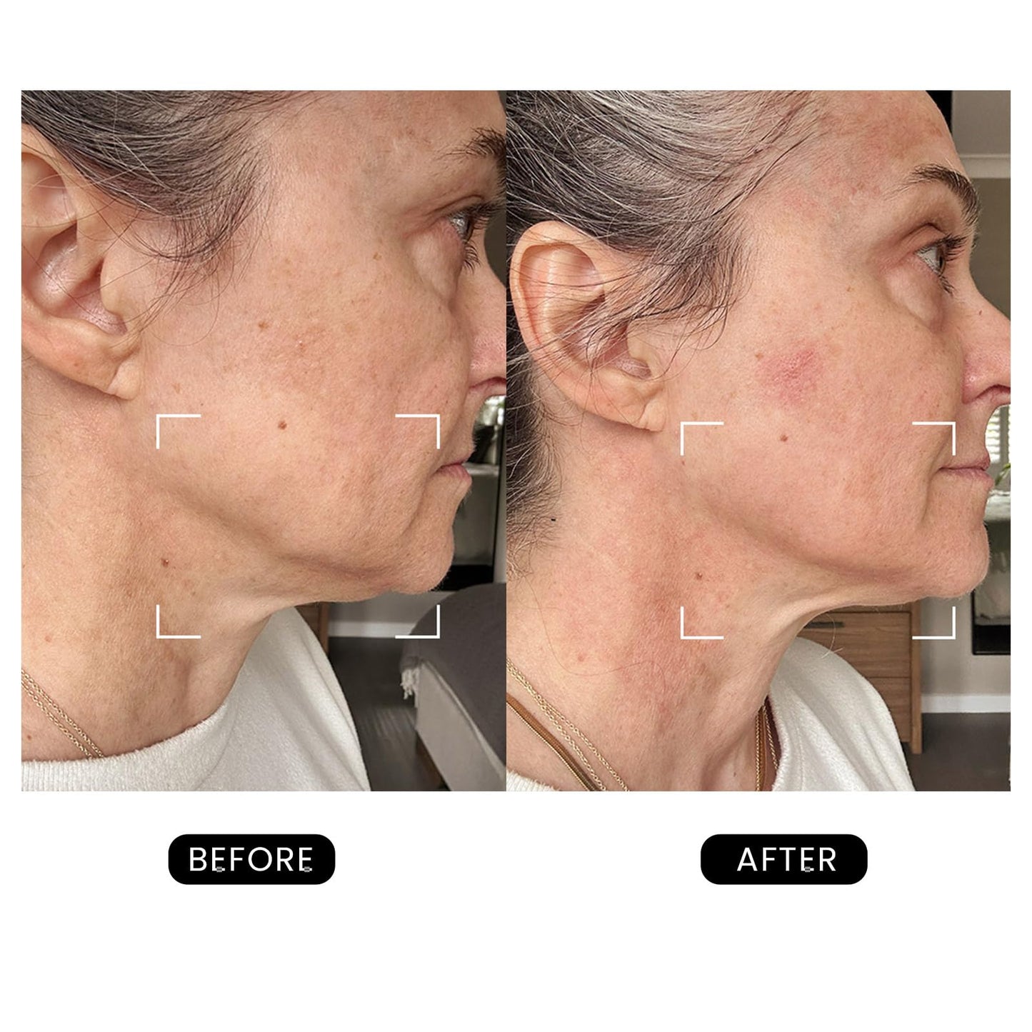 DermRays Revive Skincare for Anti-Aging, Glow Like Never Before,Multifunctional Beauty Device, Facial Massager for Home Use - Medaid International