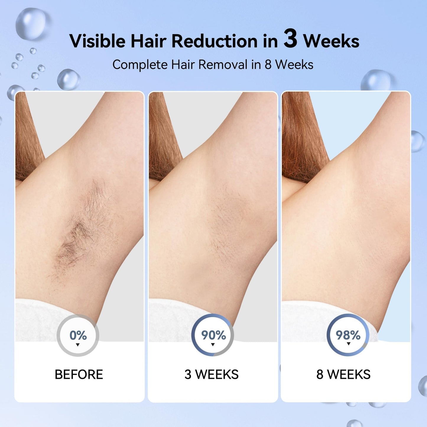 Laser Hair Removal for Women, IPL Laser Hair Removal Device, Painless Hair Remover at Home with Sapphire Ice-Cooling, Long-Lasting Hair Reduction in 3 Weeks for Face Body Bikini, Gifts for Women Her - Medaid International