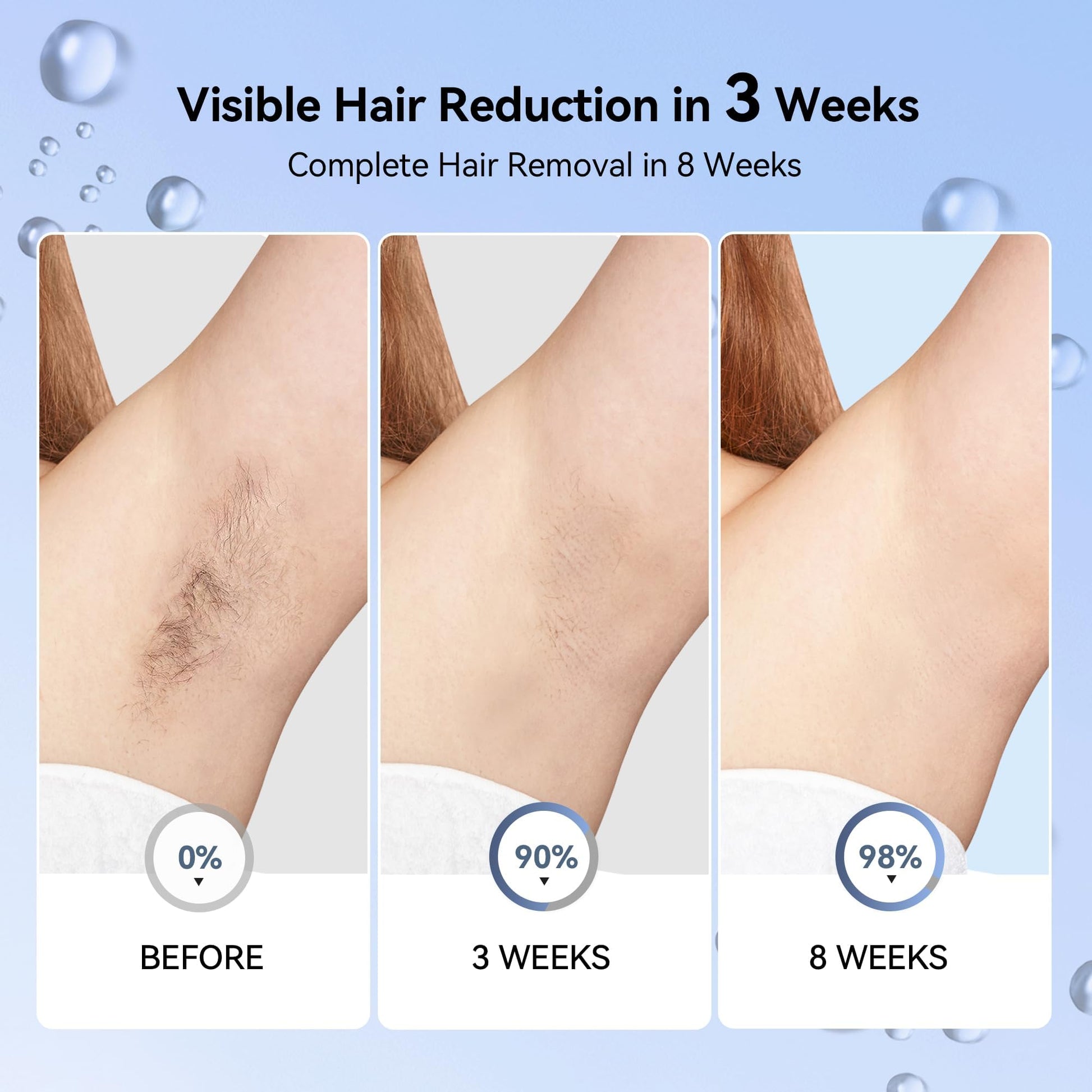 Laser Hair Removal for Women, IPL Laser Hair Removal Device, Painless Hair Remover at Home with Sapphire Ice-Cooling, Long-Lasting Hair Reduction in 3 Weeks for Face Body Bikini, Gifts for Women Her - Medaid International
