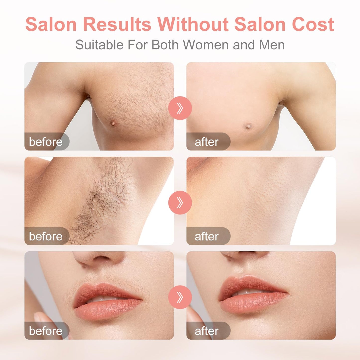 Aphrona® Hair Removal | For Full Body, Face, Sideburns, Stomach, Arms | Easy to Use |Safe & Effective Laser Hair Remover | Long-Lasting Hair Removal | FDA Cleared - Medaid International