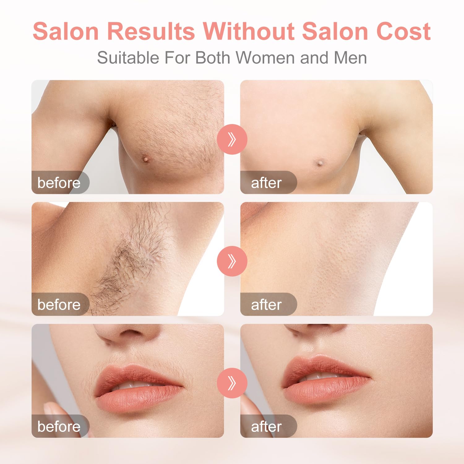 Aphrona® Hair Removal | For Full Body, Face, Sideburns, Stomach, Arms | Easy to Use |Safe & Effective Laser Hair Remover | Long-Lasting Hair Removal | FDA Cleared - Medaid International