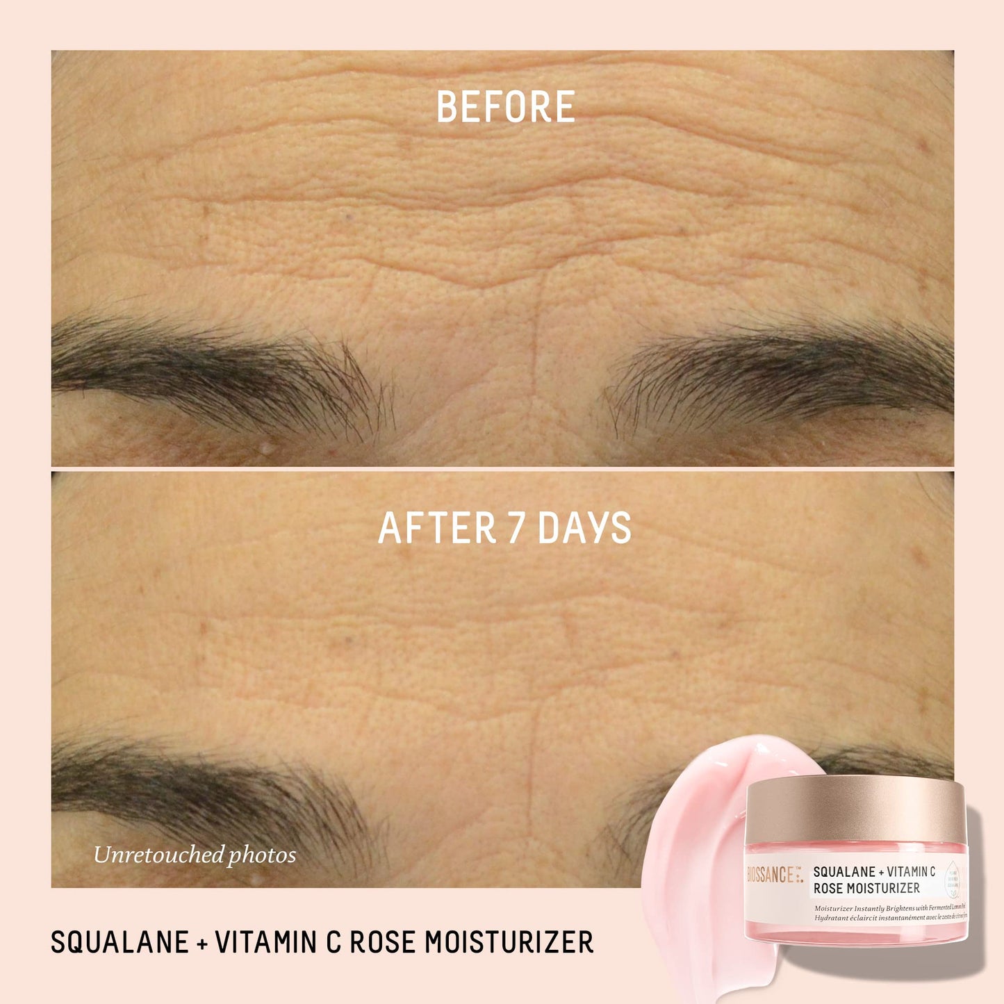 BIOSSANCE Squalane + Vitamin C Rose Face Moisturizer – Antioxidant-Rich Day/Night Face Lotion – Hydrates and Smooths Fine Lines – Even Skin Tone & Reduce Discoloration – For Radiant Skin, 1.69 Fl Oz - Medaid International