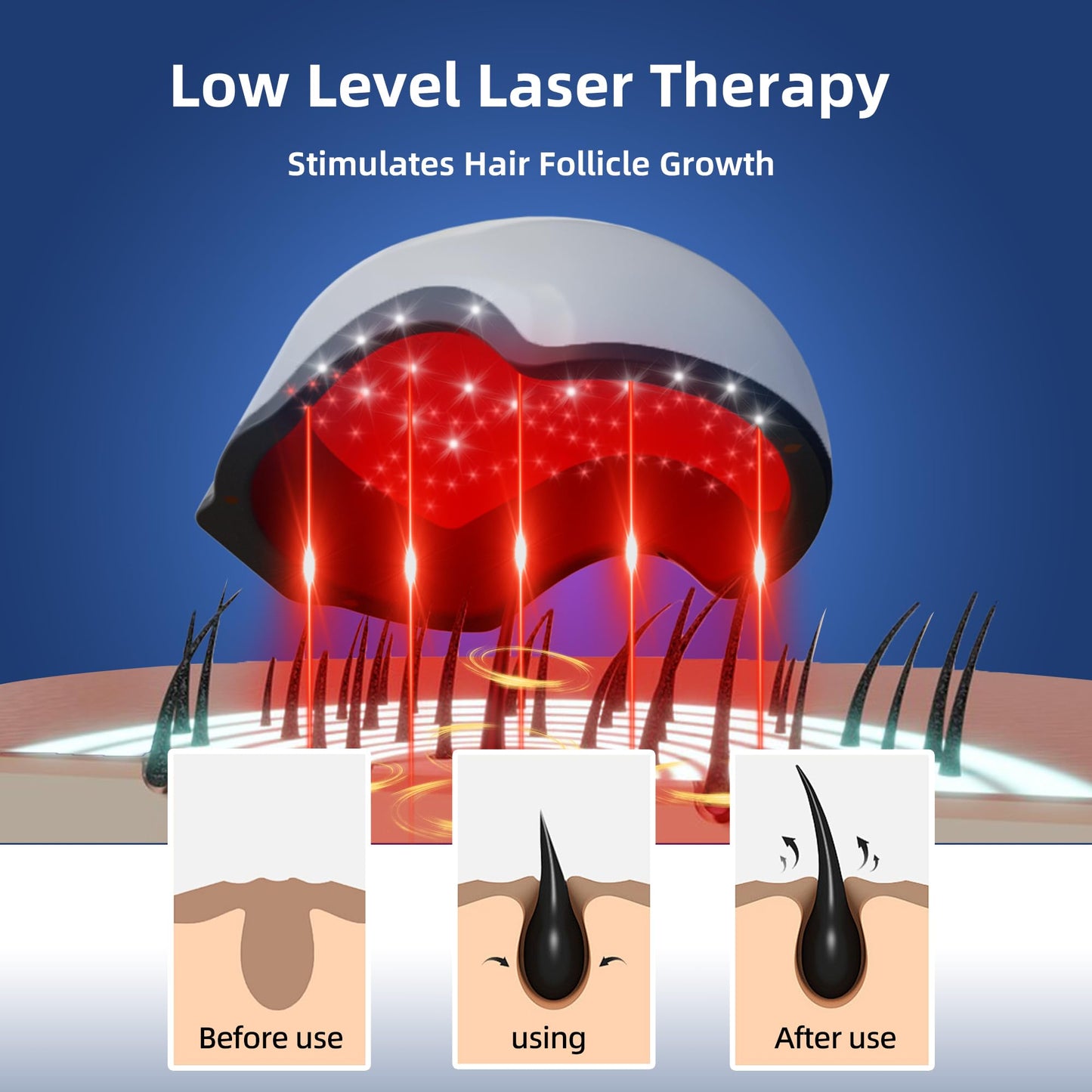 Laser Red Light Therapy for Hair Growth Device, FDA Cleared Hair Loss, Hair Growth Device - Medaid International