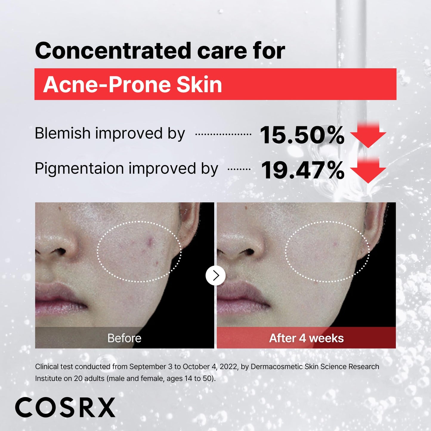 COSRX 15% Niacinamide Face Serum, 0.67 fl oz, Pore Minimizer Serum for Face, Even Skin Tone, Korean Skin Care - Medaid International