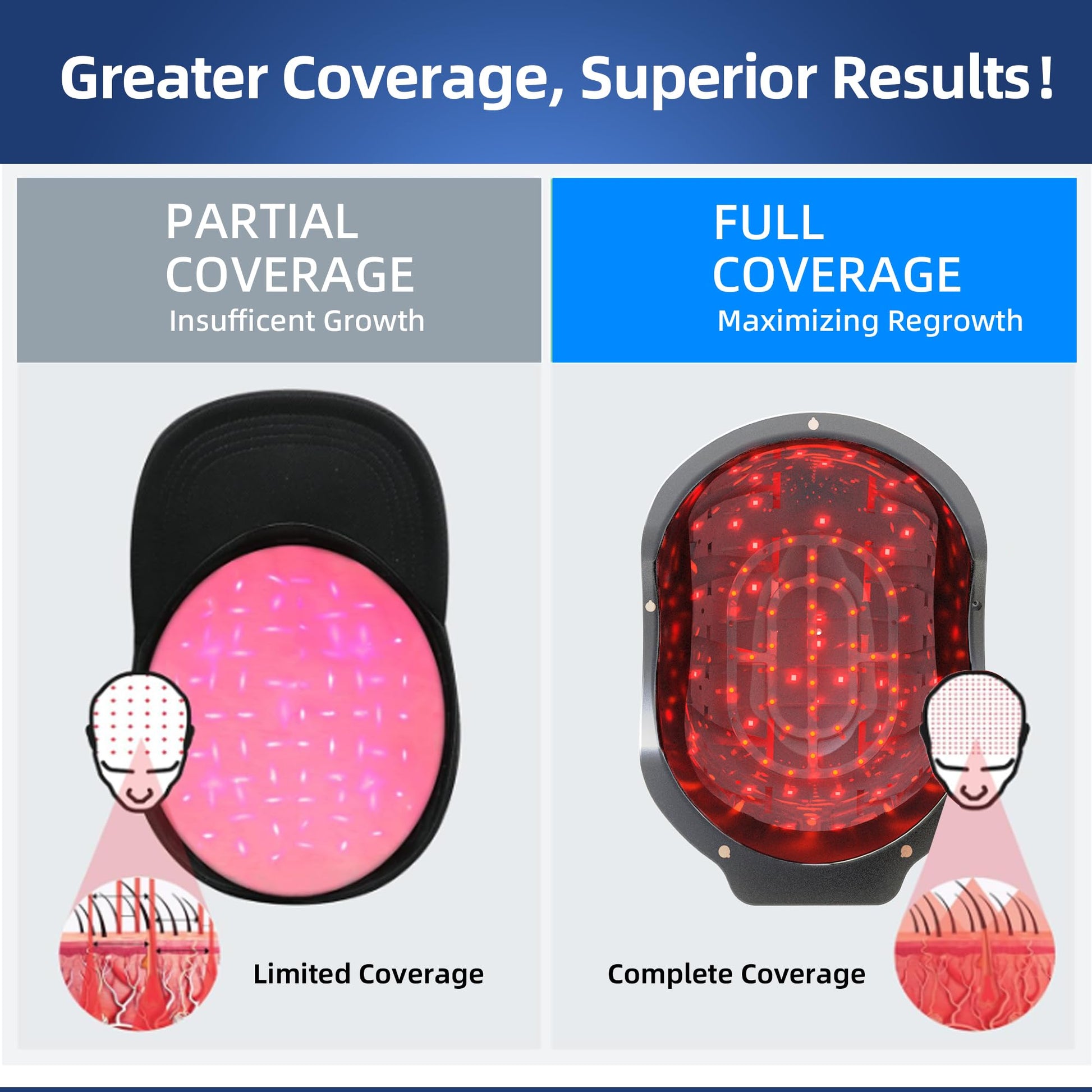 Laser Red Light Therapy for Hair Growth Device, FDA Cleared Hair Loss, Hair Growth Device - Medaid International