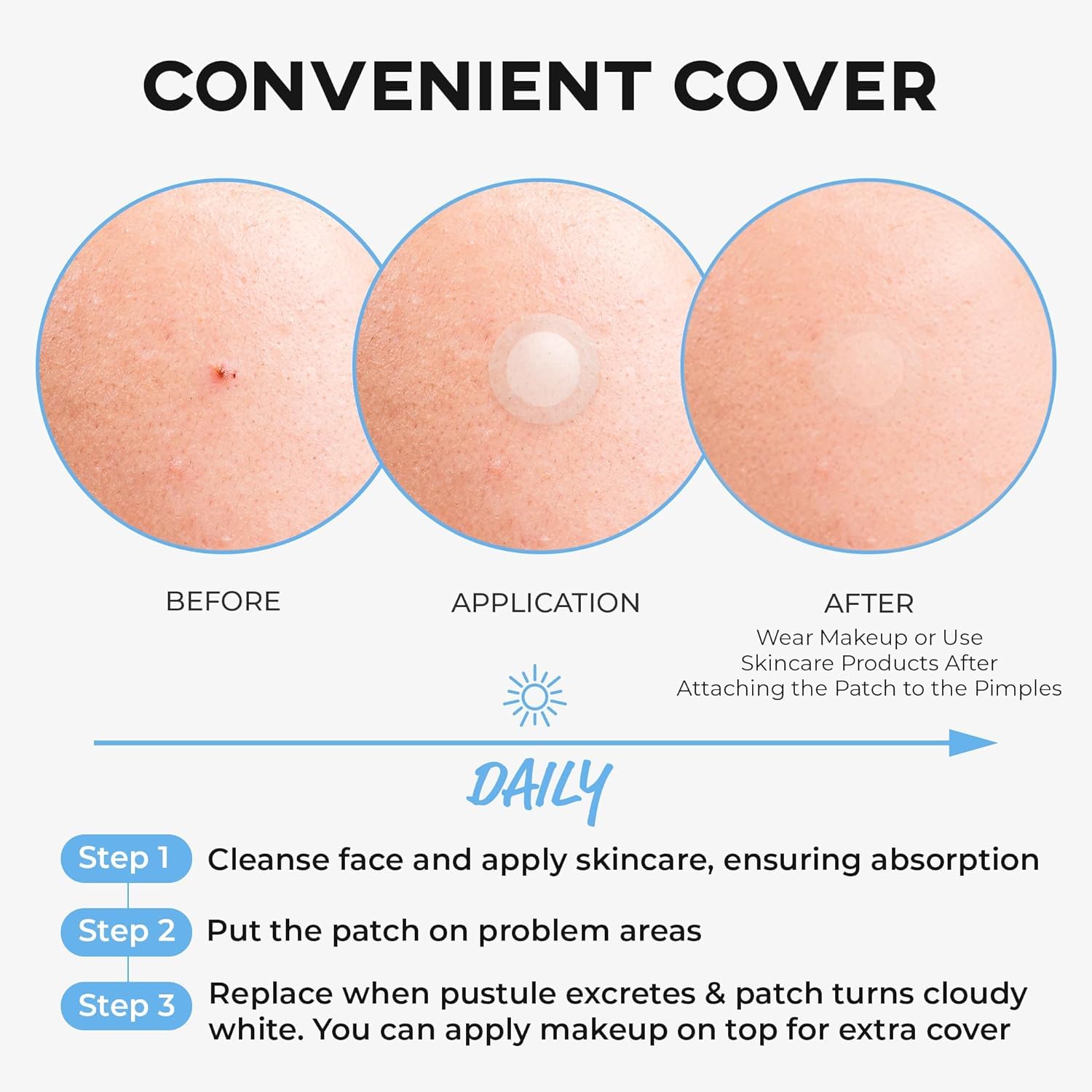 NOLAHOUR Hydrocolloid Patch STEP2 | Invisible Ultra-Thin Bandages | Vegan Patch for Pimple-Prone Skin | Korean Skin Care Face Pimple Patches (Pack of 1, 63 Patches) - Medaid International